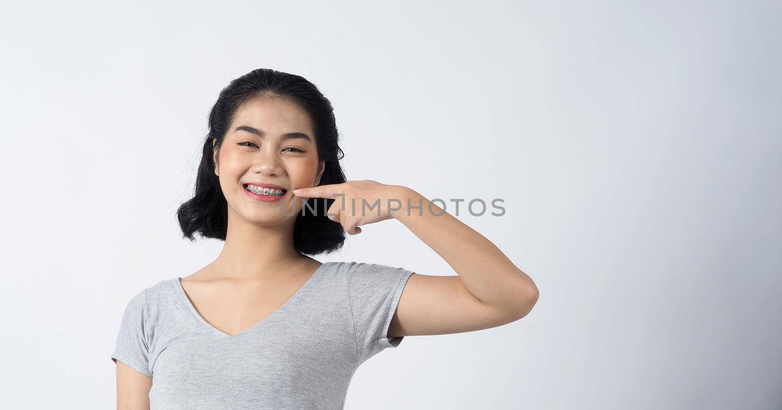 Dental braces of teen asian woman wearing braces teeth and contact lenses, she very confident and proudly present herself and smile on white background studio shot, Happiness teenager smiling facial expression.