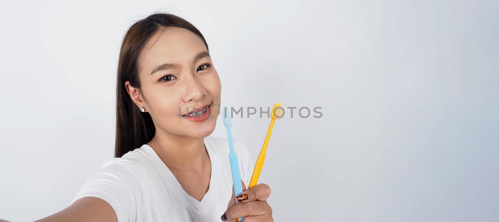 Asian teen facial with braces and toothbrush smiling to camera to show dental orthodonic teeth which include professional metal wire material from orthodontist. studio shot white background. Dental brace concept.
