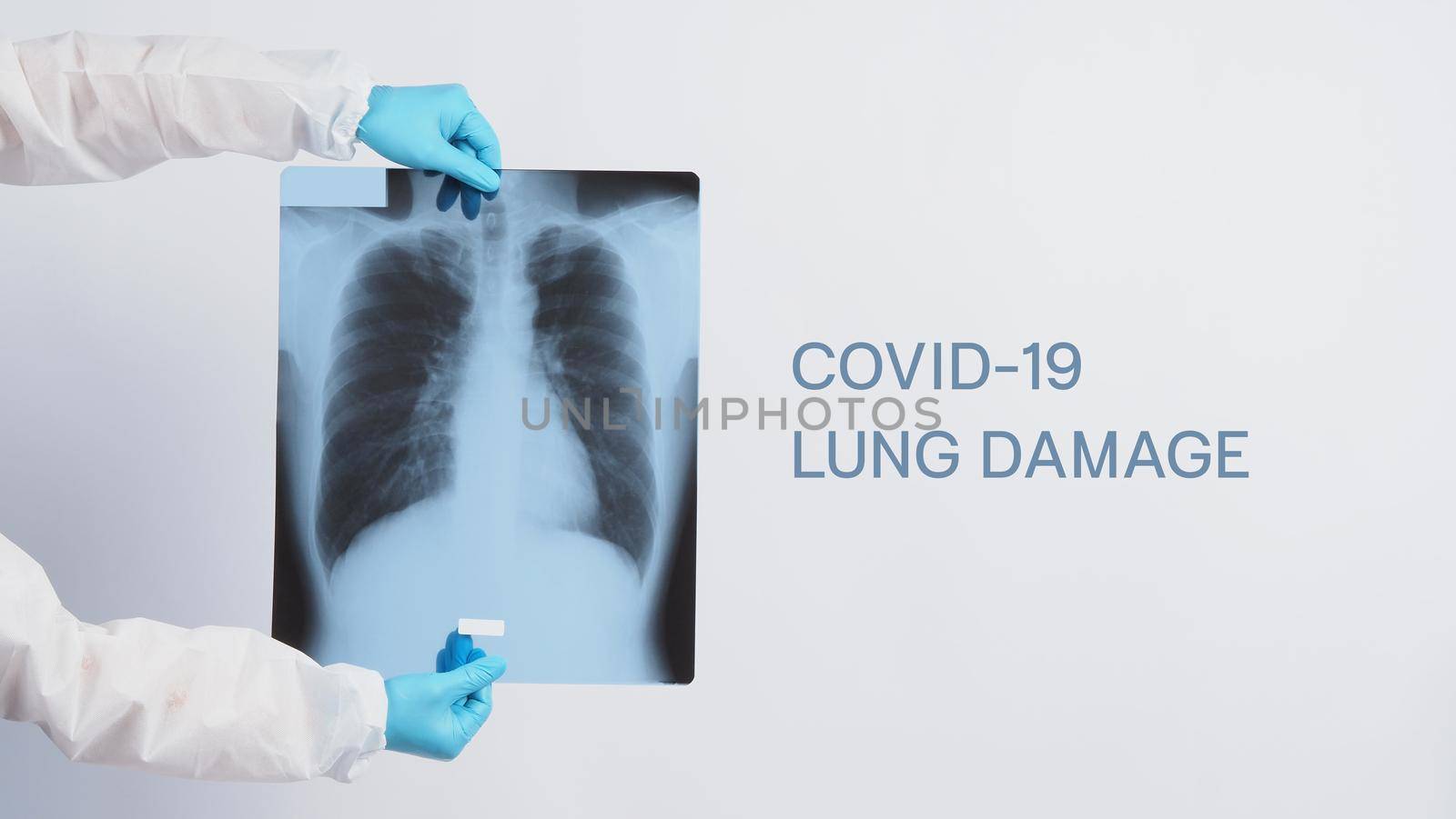 Xray film of Covid 19 lung damage and holding by doctor hand in medical glove and PPE or Personal Protection Equipment suit. Studio shot white background. Coronavirus pandemic and Healthcare medical concept.