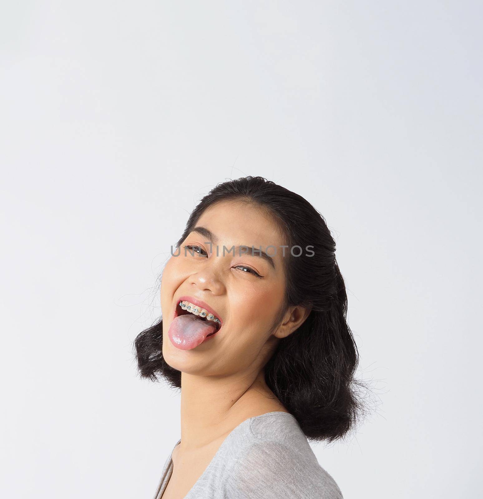 Dental brace beautiful girl smiling looking on a camera. white teeth with blue braces. Dental care. Asian teen woman smile with orthodontic accessories. Cosmetic dentistry, orthodontics treatment. white background studio.