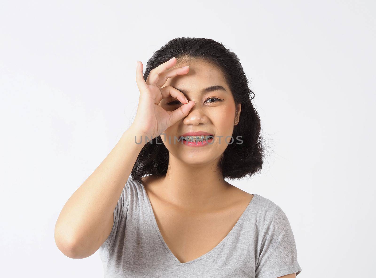 Dental brace beautiful girl smiling looking on a camera. by gnepphoto