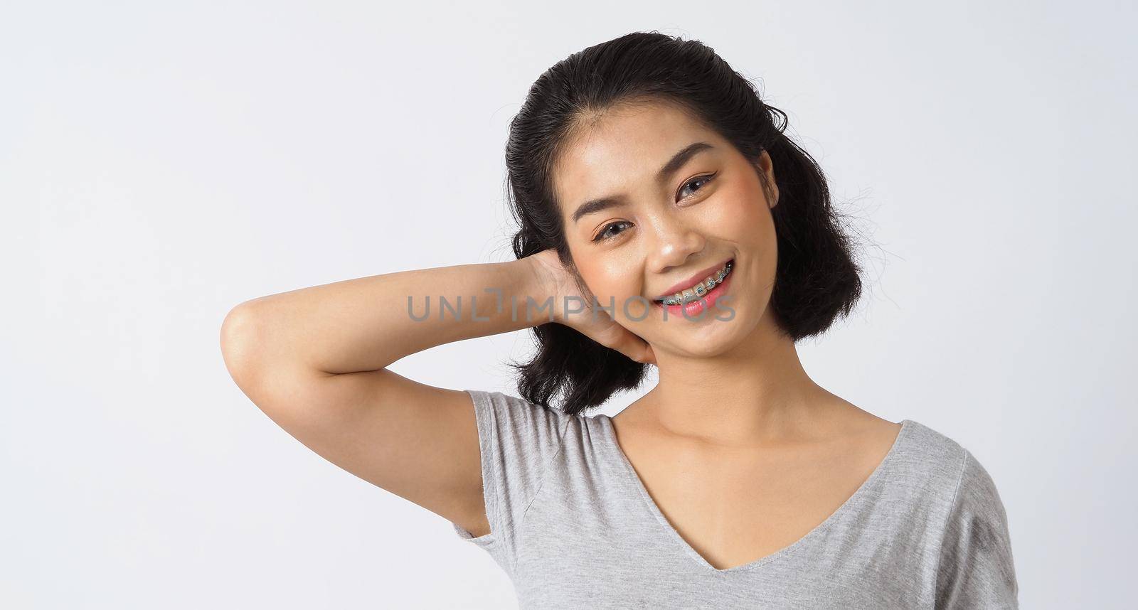 Dental brace teen girl smiling looking on a camera. by gnepphoto