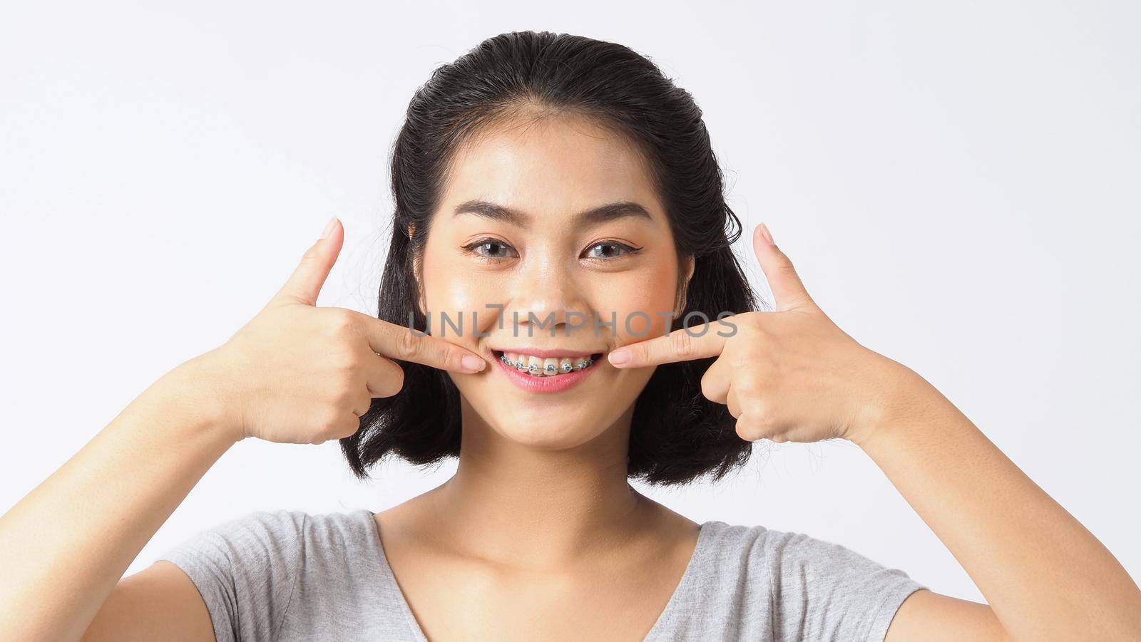 Dental brace teen girl smiling looking on a camera. by gnepphoto