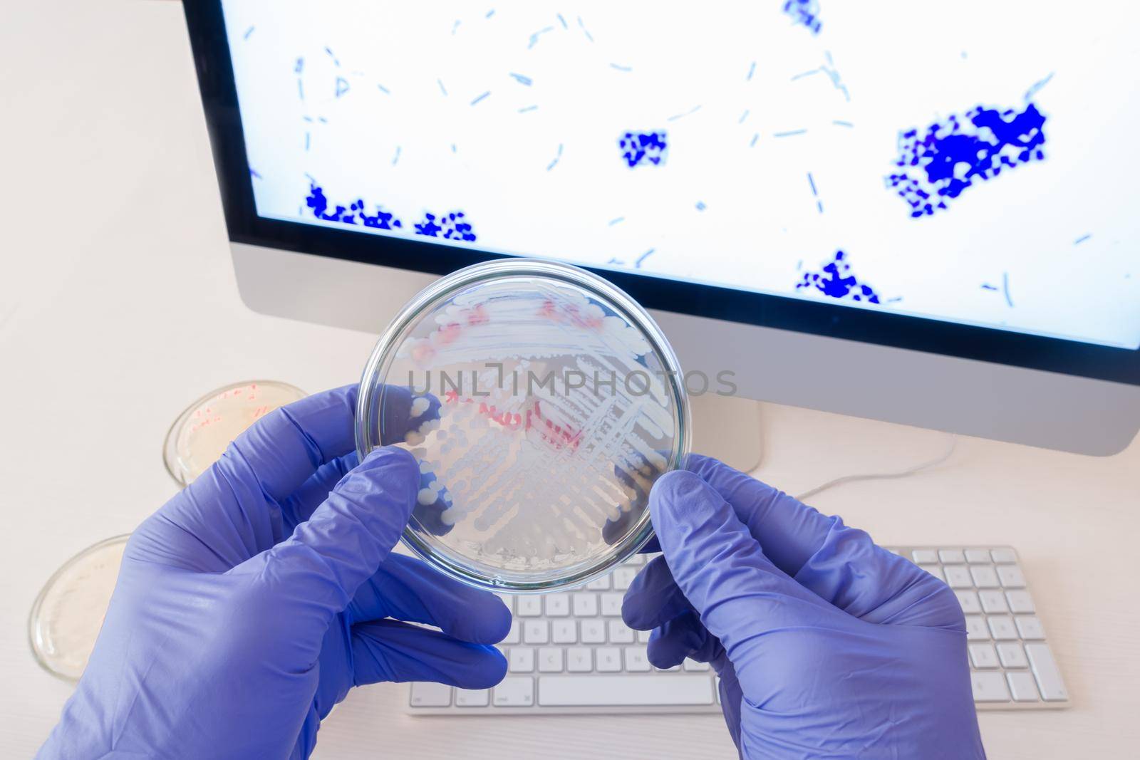Analysis of bacteria on a Petri dish in front of a monitor with a photo of bacteria.