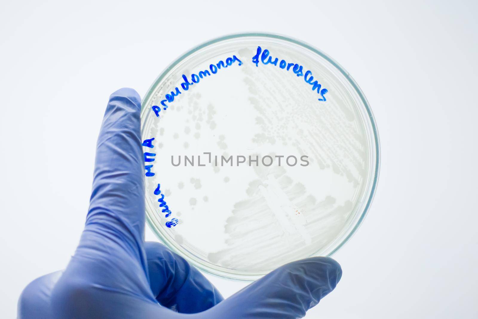 The scientist examines a cup of petrie with colonies of bacteria on a white background. Hands in blue gloves hold a petri dish. A scientist holding a petri dish in front of him.