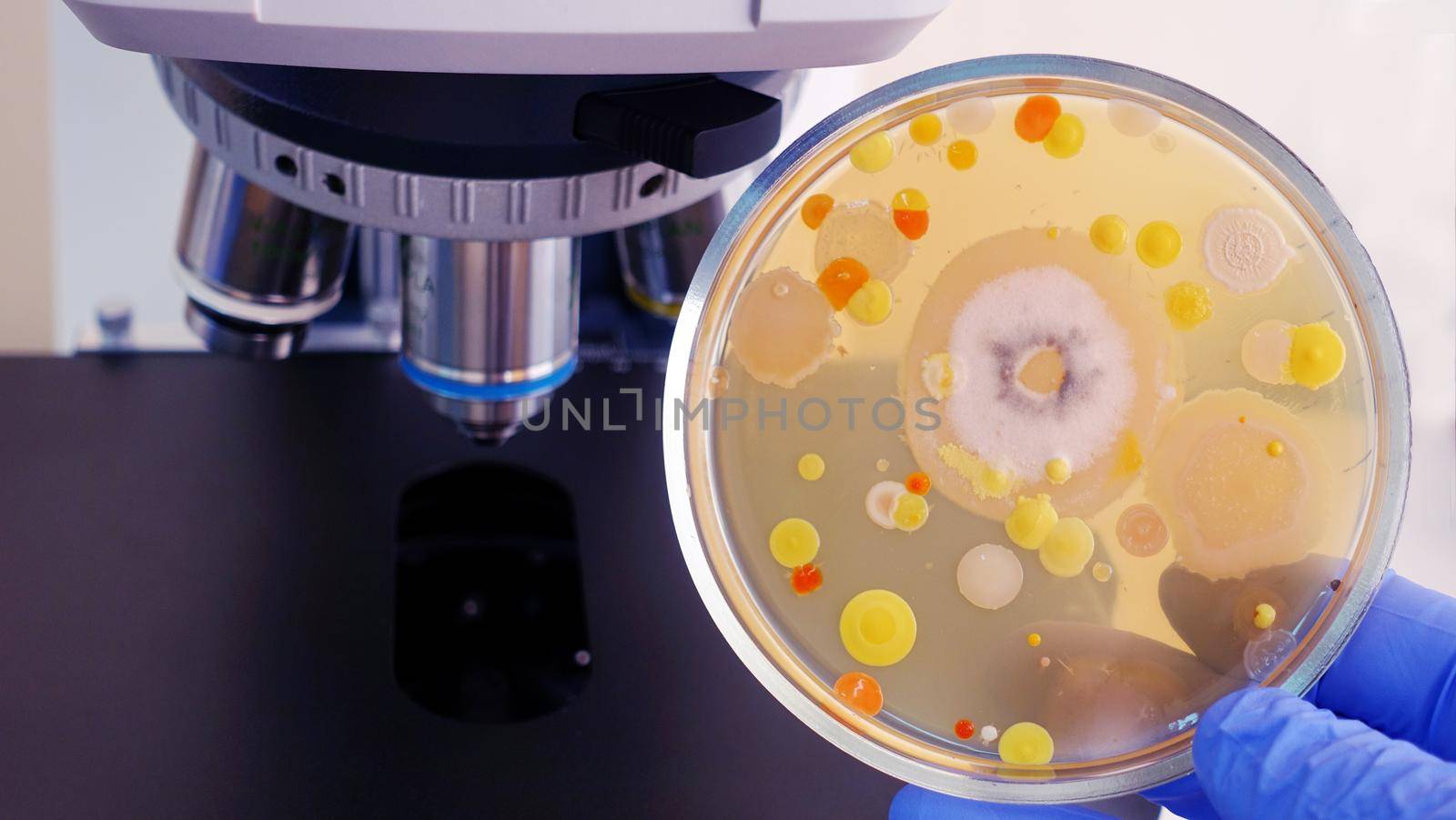 A Petri dish with colored bacteria on the background of the microscope. Bacterial analysis in the laboratory.