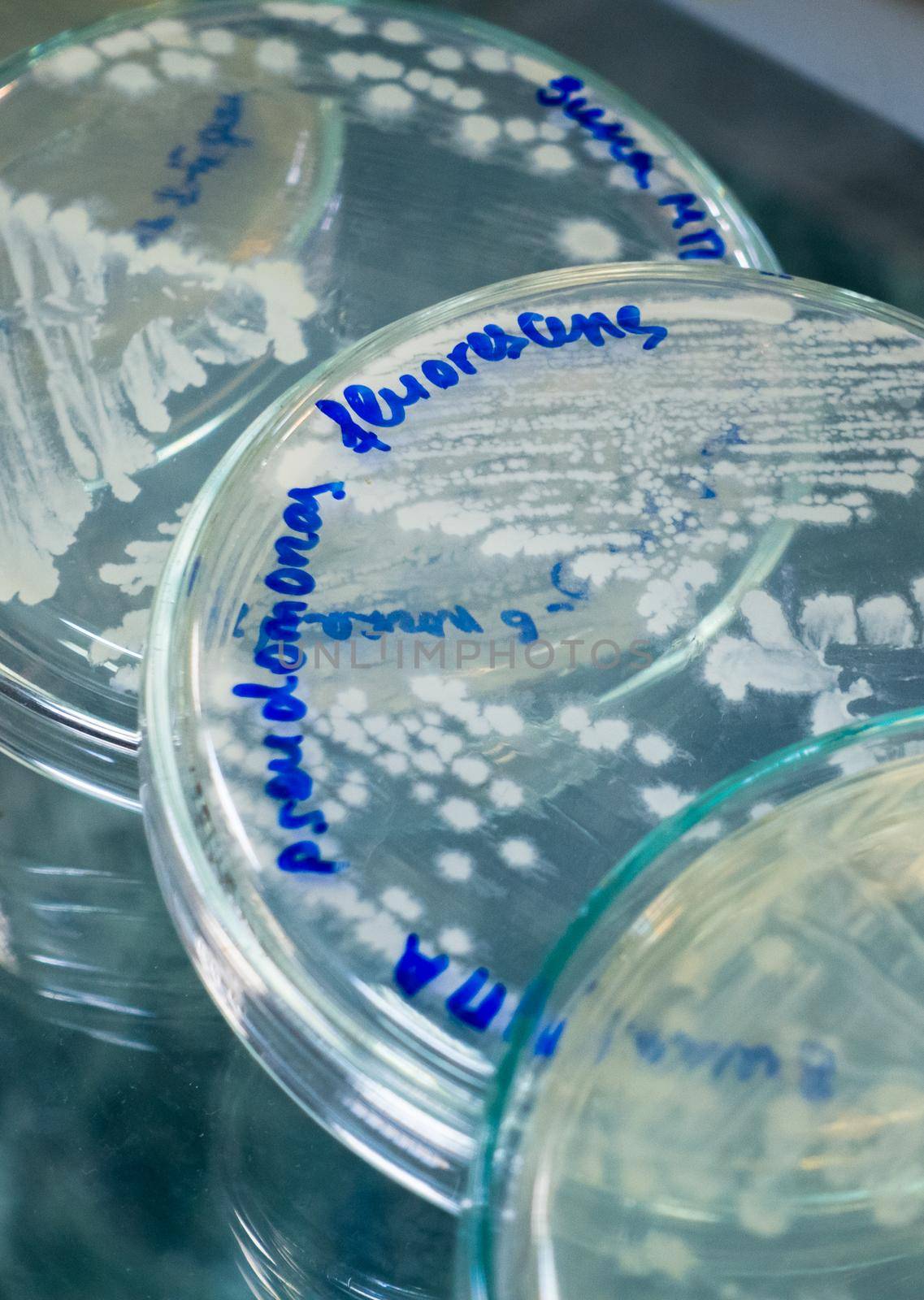 Bacterial cultures for analysis. Three Petri dishes with bacterial cultures on a rack. Individual colonies of bacteria.