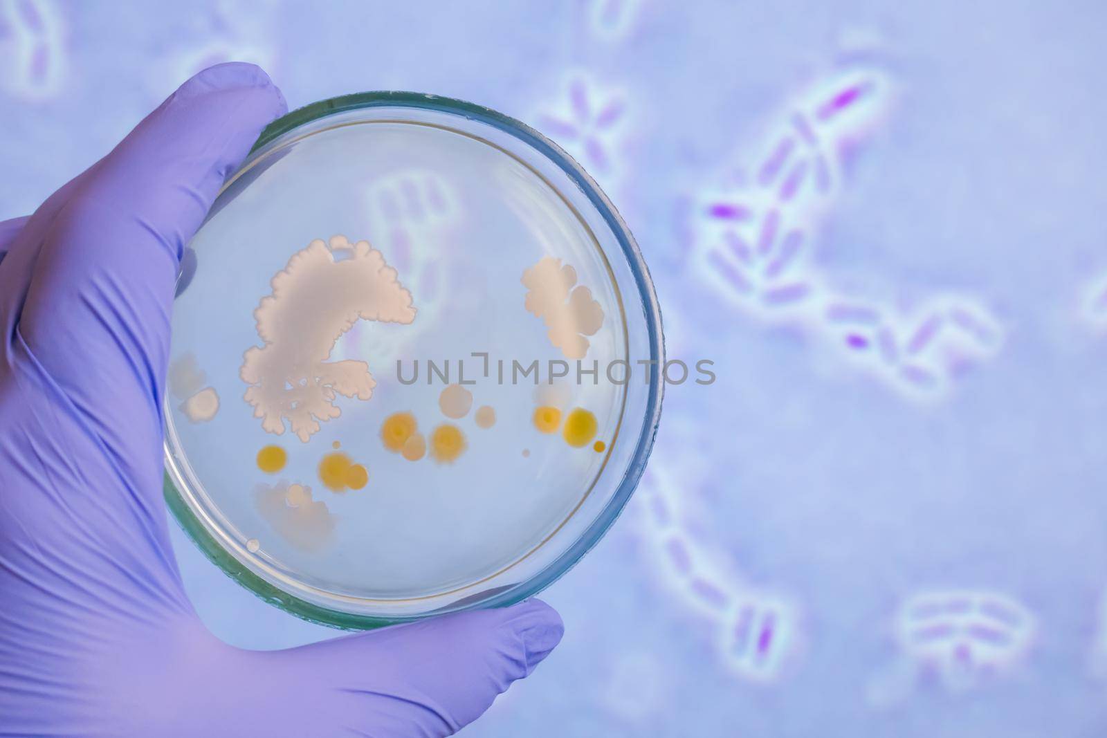 Analysis of bacterial colonies on a petri dish against bacteria. The scientist in his hand holds a Petri dish against the background of bacteria.