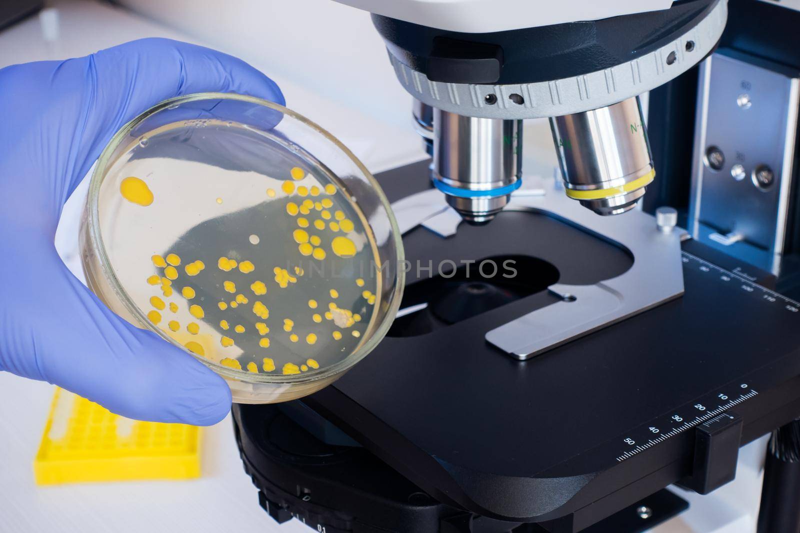 Close-up scientist holding a petri dish with bacteria on the background of a microscope. Analysis of bacterial culture under a microscope. Study of bacteria under a microscope.