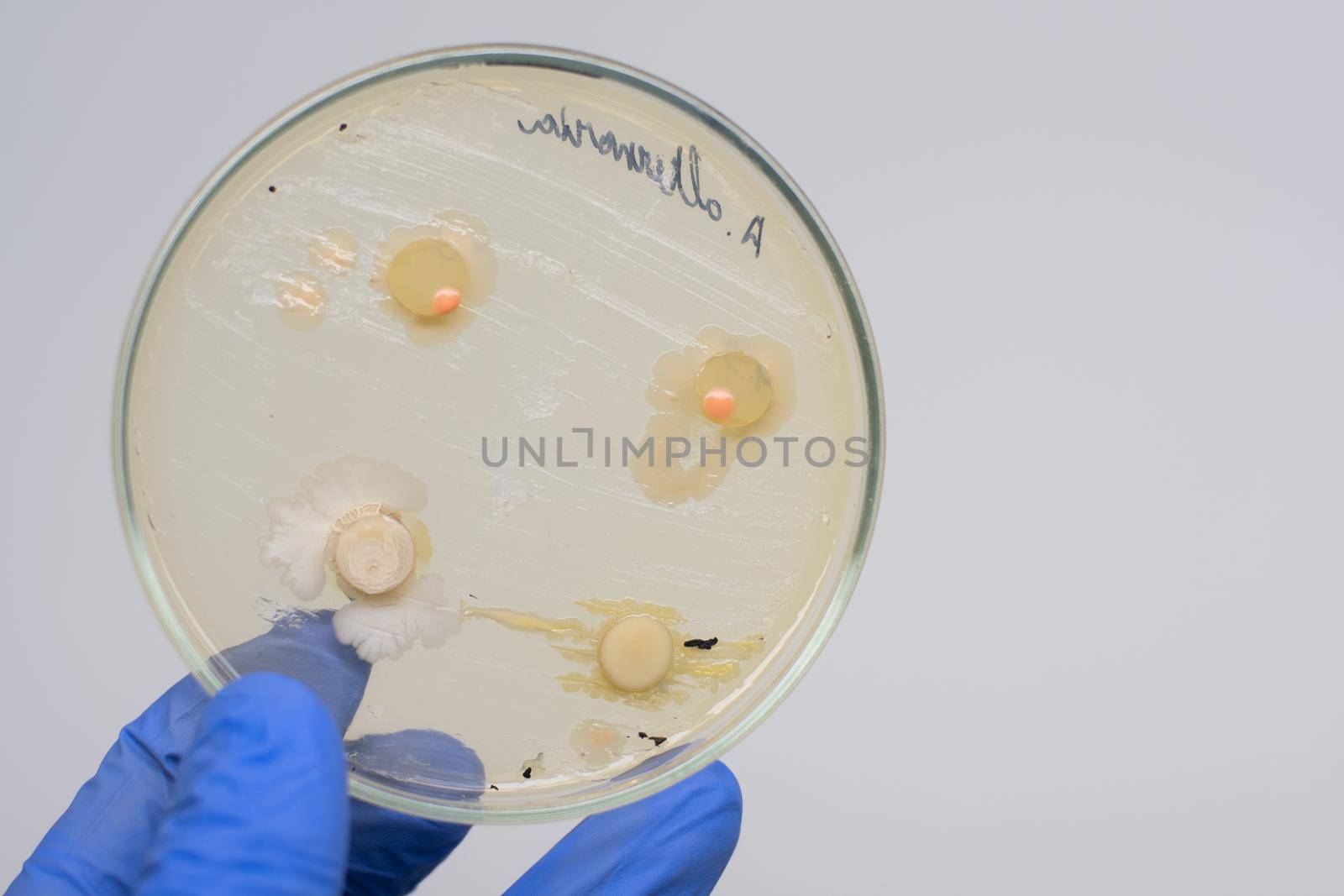 Antibiotics act on bacteria in a petri dish. by Jannetta