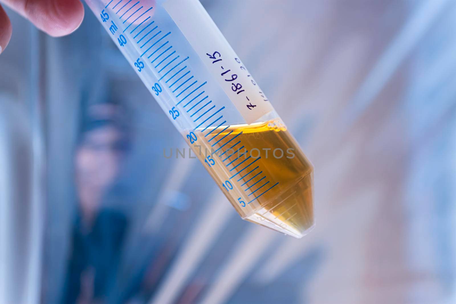 The scientist holds in his hand a transparent measuring test tube with a cloudy yellow liquid against a shiny background.