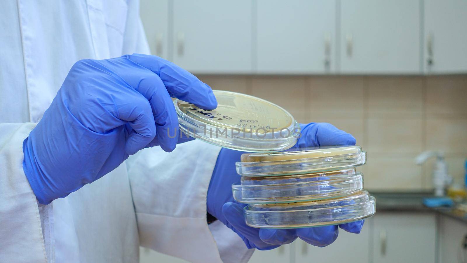 Scientist in blue gloves takes a petri dish with bacteria from a stack in his hands, standing in the laboratory, close-up.