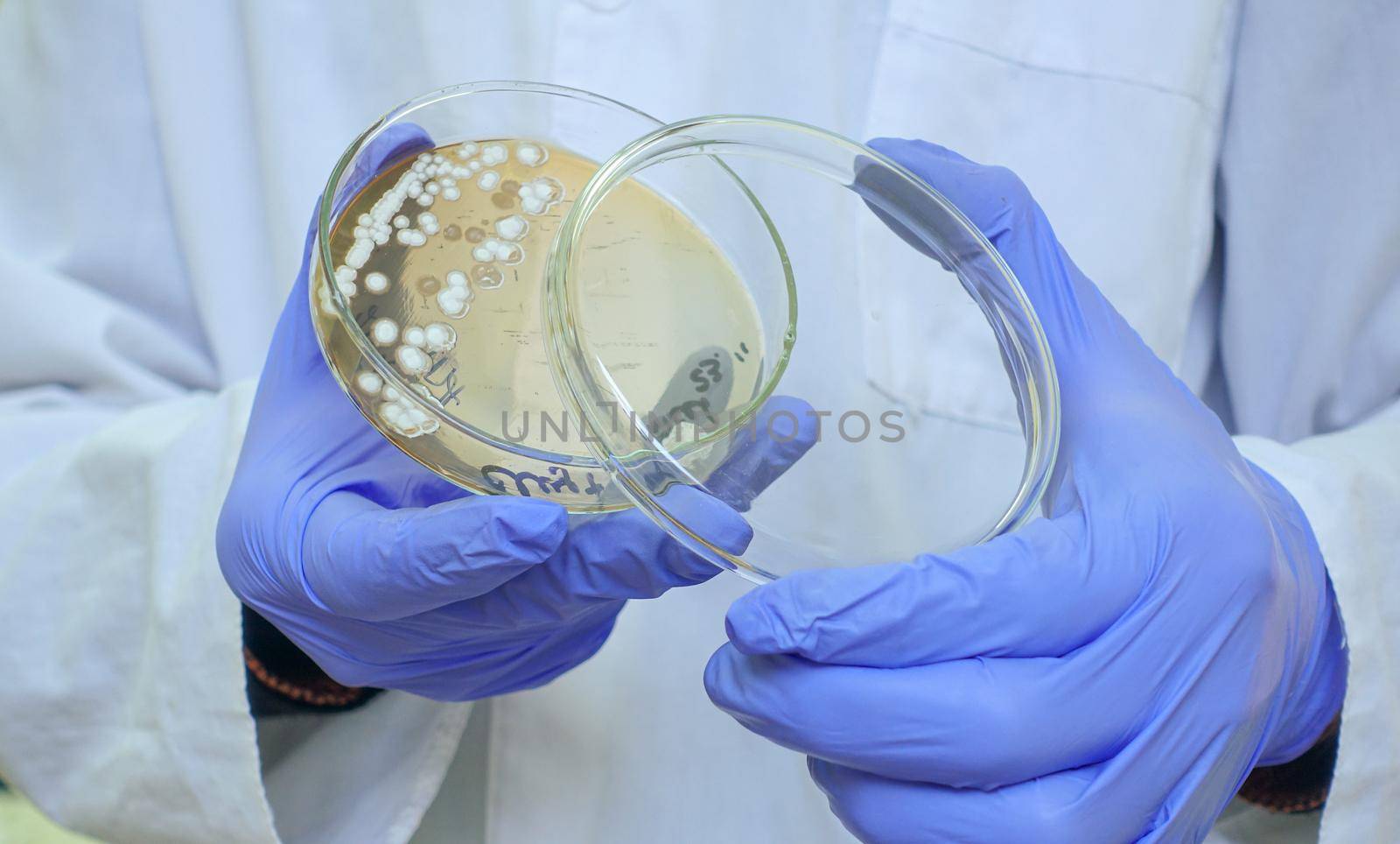 A scientist shows bacteria in a Petri dish to the camera. by Jannetta