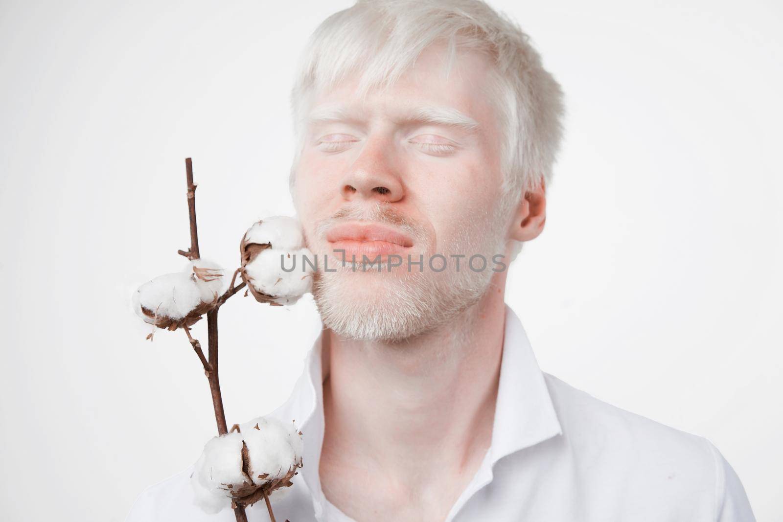 albinism Happy smile albino man white skin hair soft fluffy cotton brunch studio dressed t-shirt isolated white background abnormal deviations unusual appearance abnormality Beautiful people