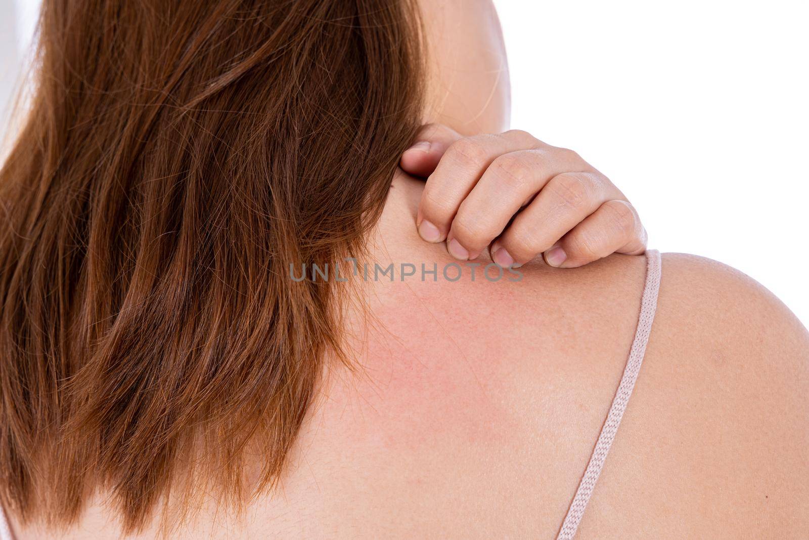 Female scratching her back isolated white background. Medical, healthcare for advertising concept.