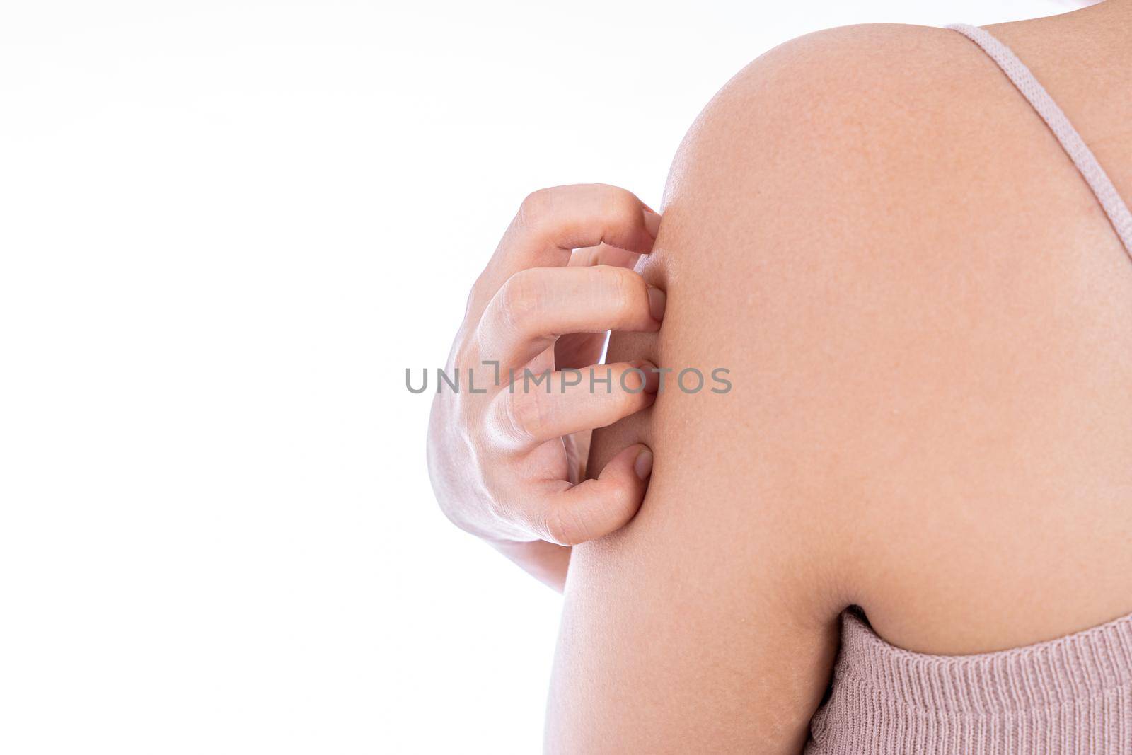 Female scratching her arm isolated white background. Medical, healthcare for advertising concept. by mikesaran