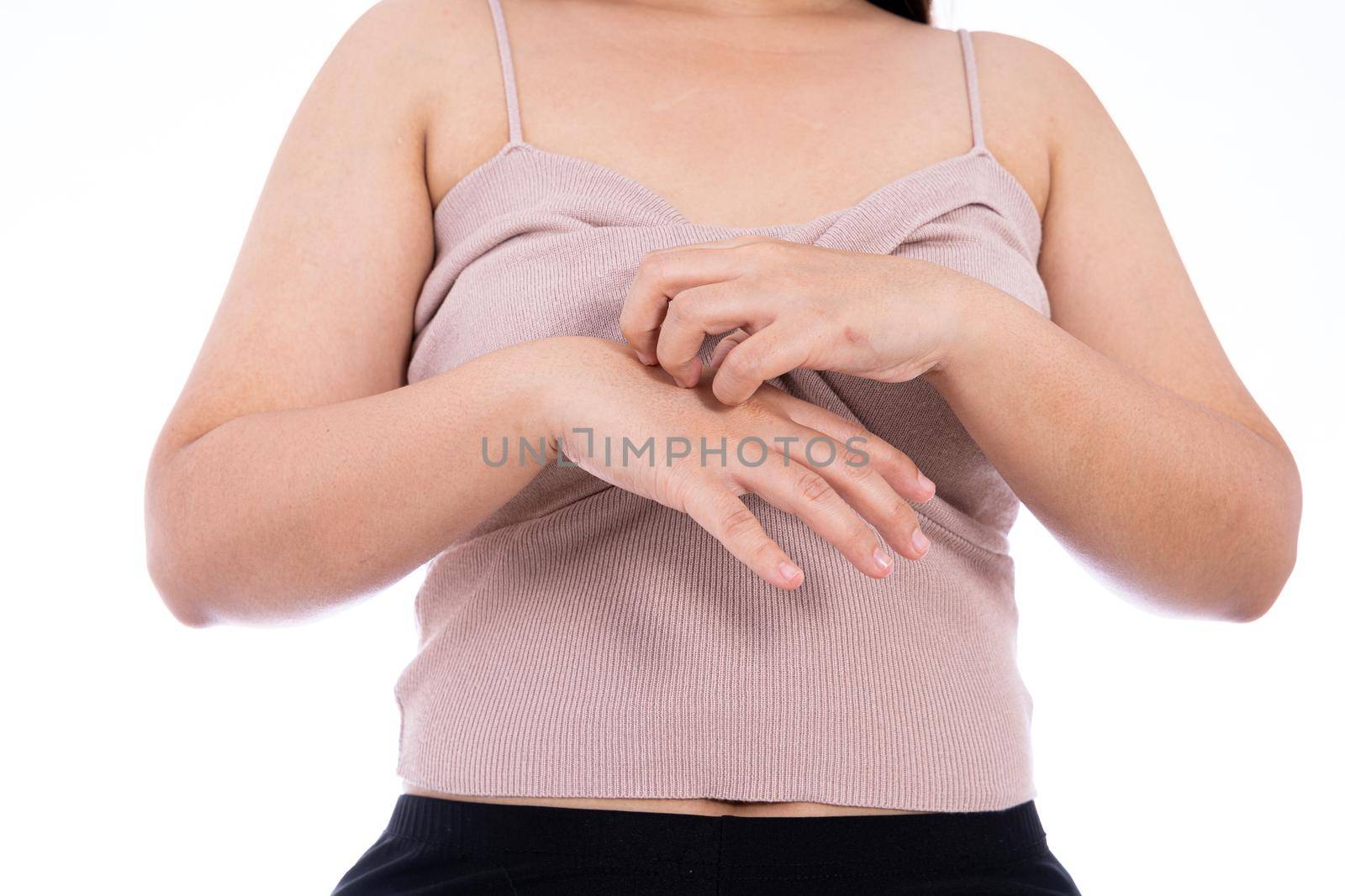 Female scratching her hand isolated white background. Medical, healthcare for advertising concept. by mikesaran