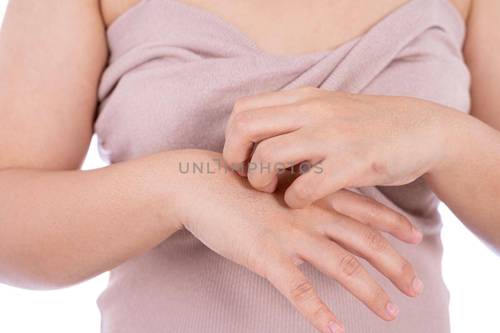 Female scratching her hand isolated white background. Medical, healthcare for advertising concept.
