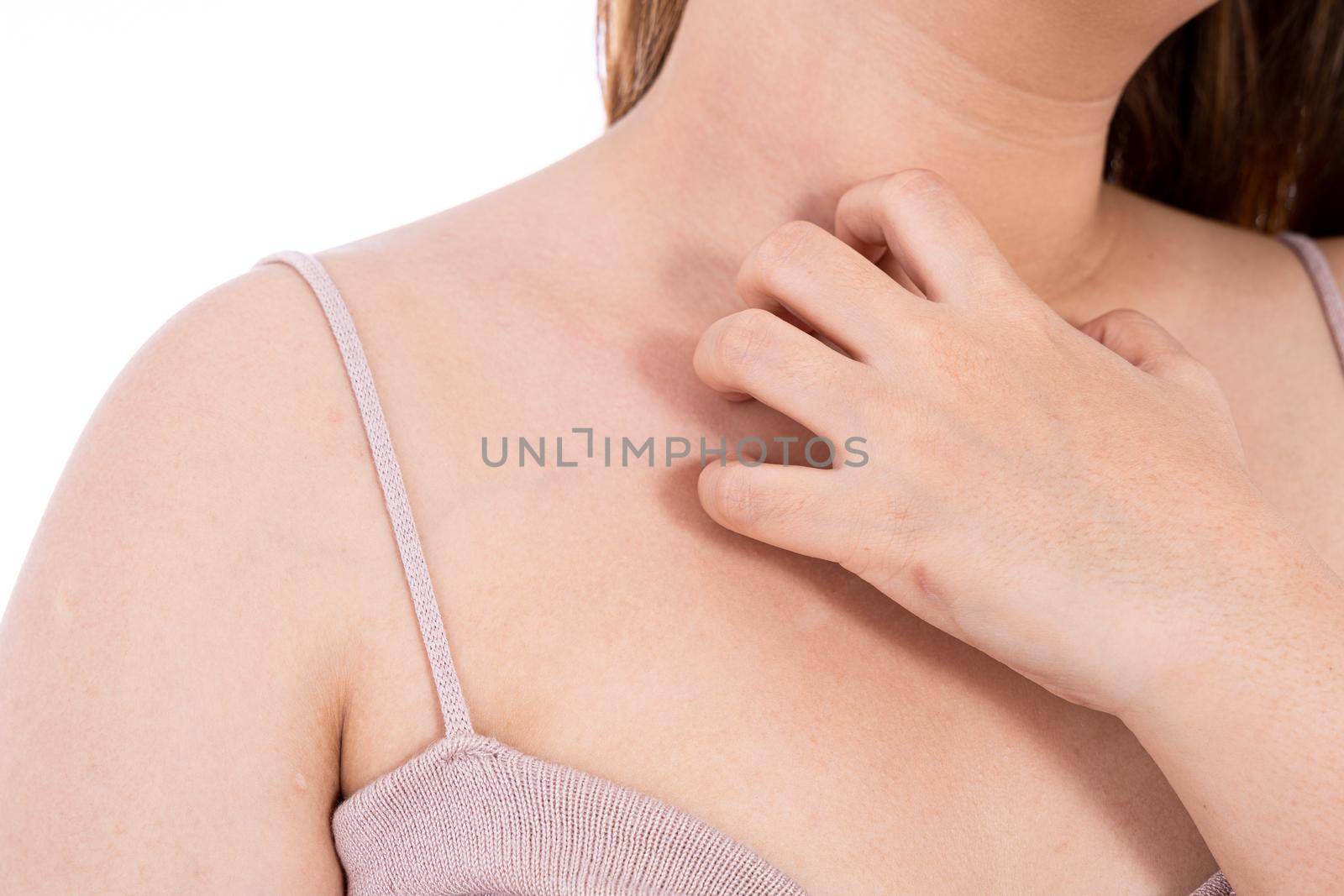 Female scratching her chest isolated white background. Medical, healthcare for advertising concept. by mikesaran