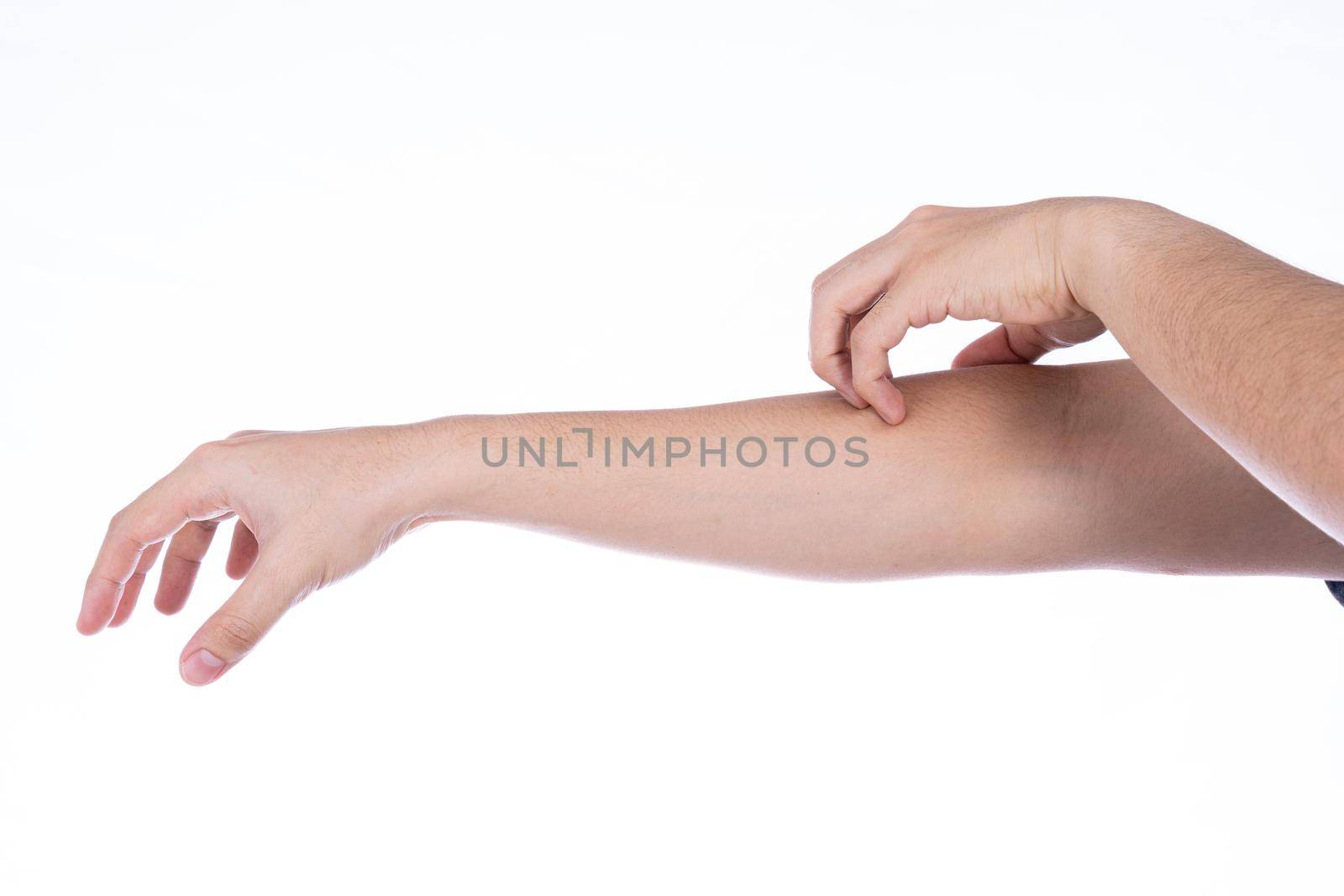 Man hand scratching his arm isolated white background. Medical, healthcare for advertising concept.