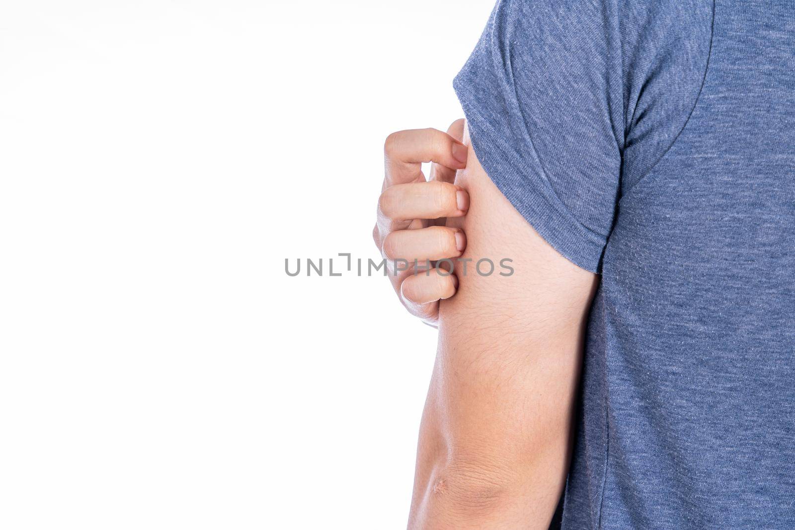 Male scratching his arm isolated white background. Medical, healthcare for advertising concept. by mikesaran