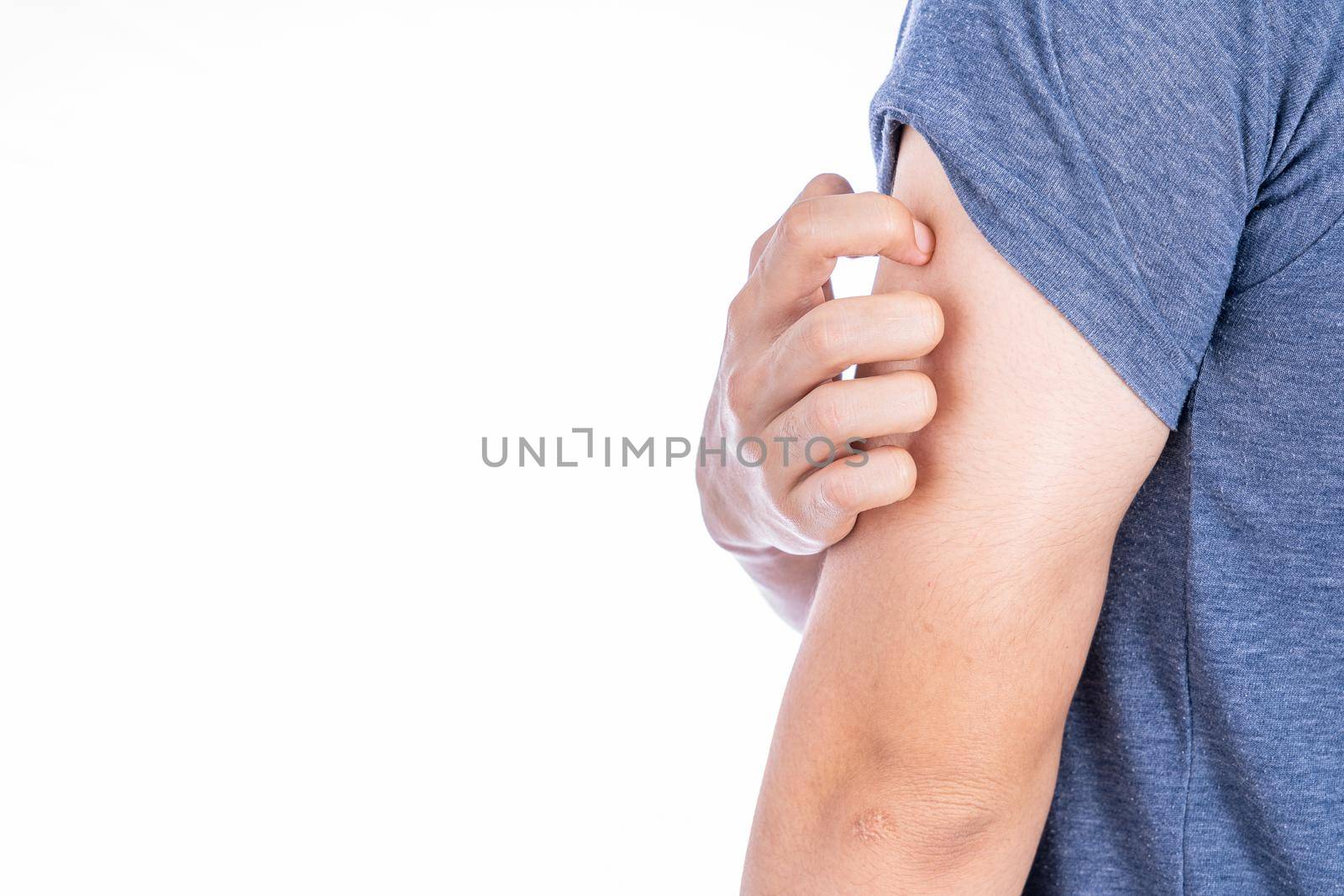 Male scratching his arm isolated white background. Medical, healthcare for advertising concept. by mikesaran