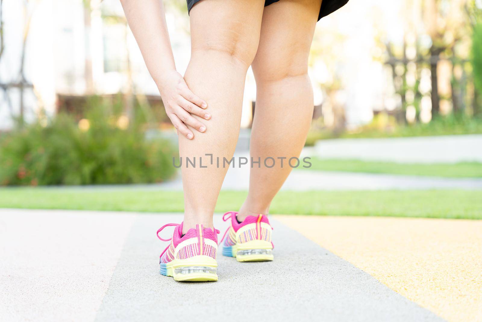 Female fatty runner athlete leg injury and pain. Hands grab painful leg while running in the park. by mikesaran