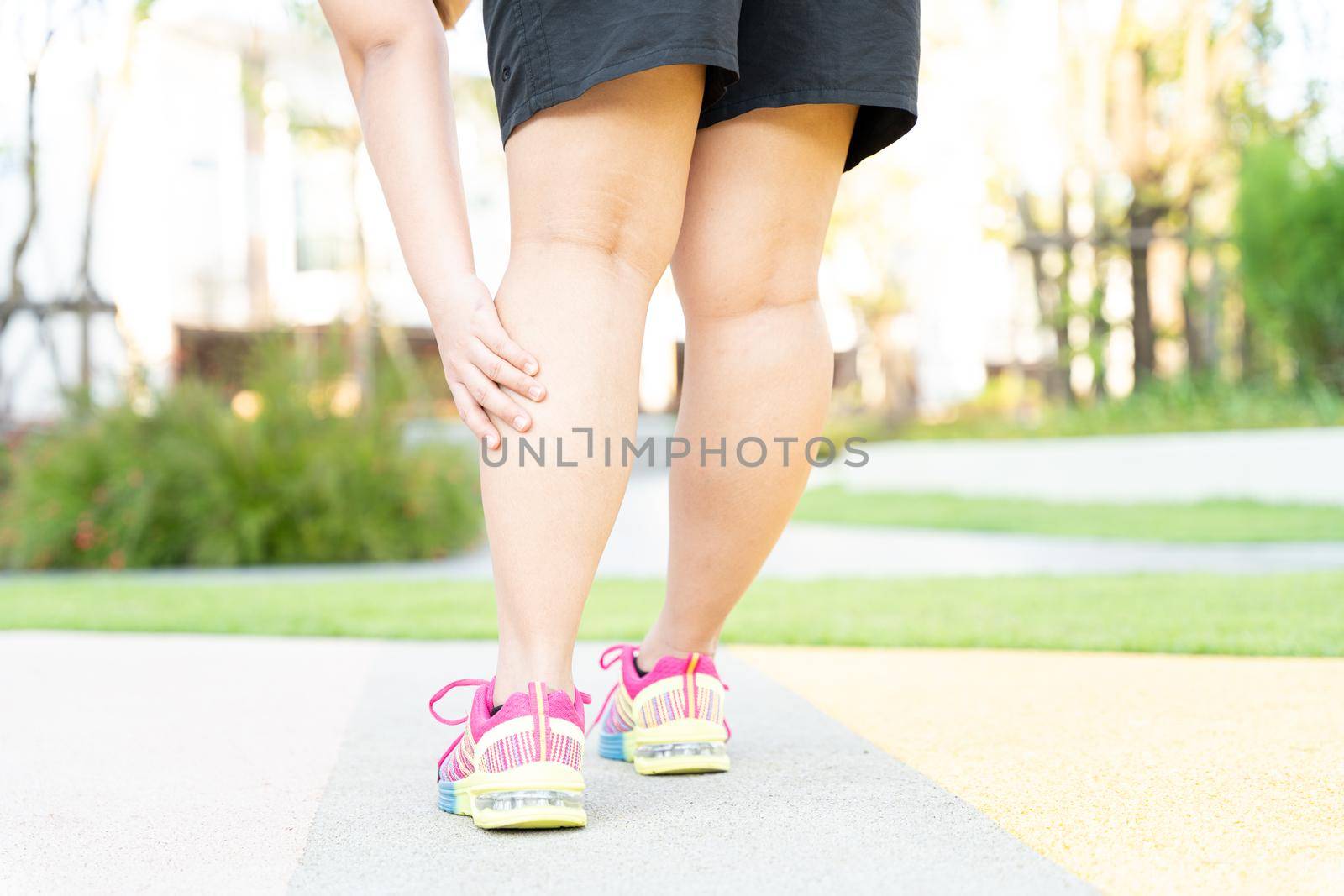 Female fatty runner athlete leg injury and pain. Hands grab painful leg while running in the park.