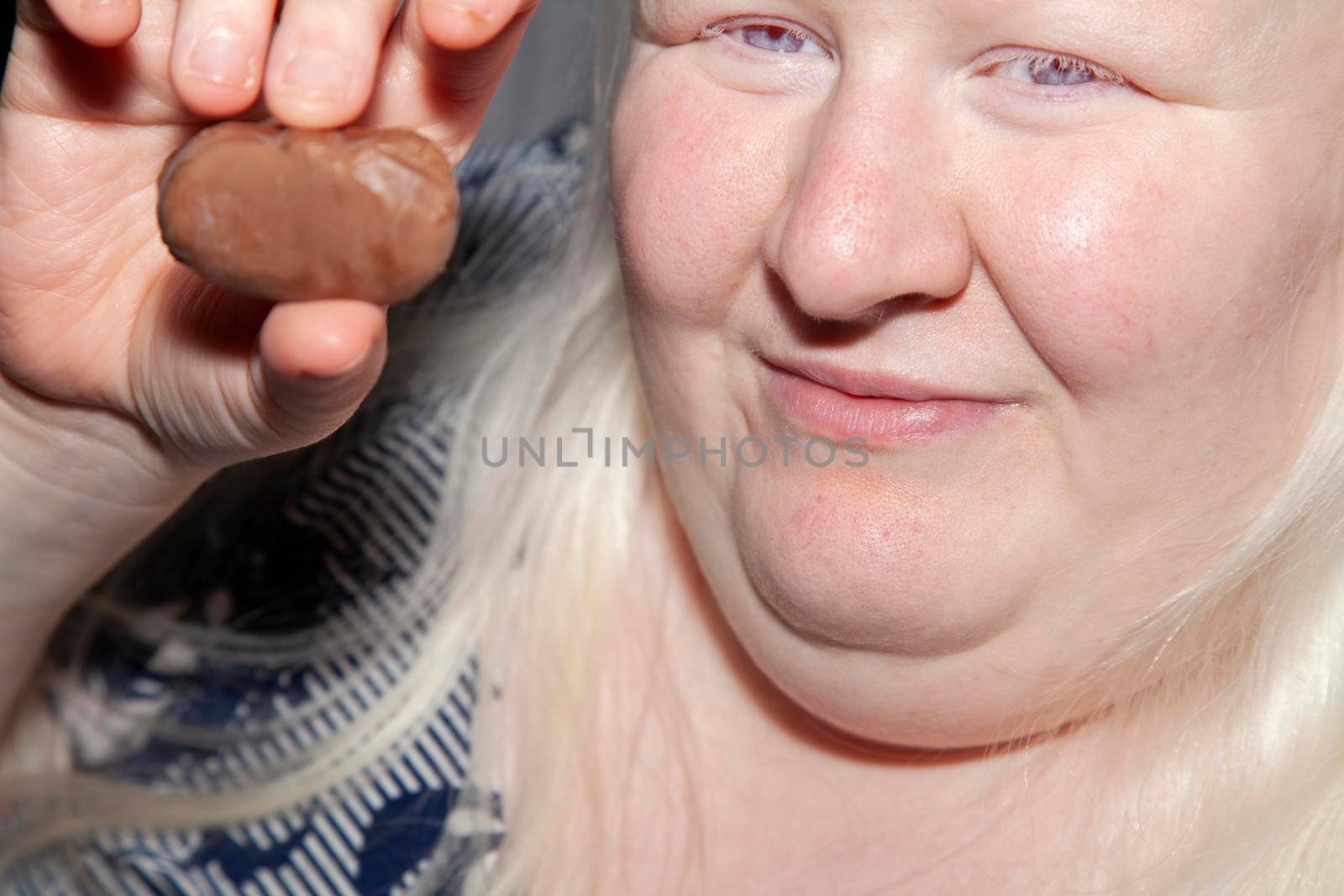 Obese, albino woman holding a piece of chocolate