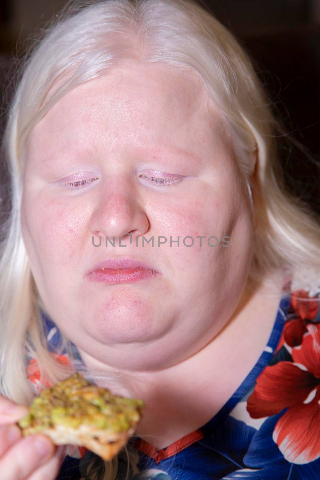 Albino woman thinking serious or sad thoughts while she eats avocado toast