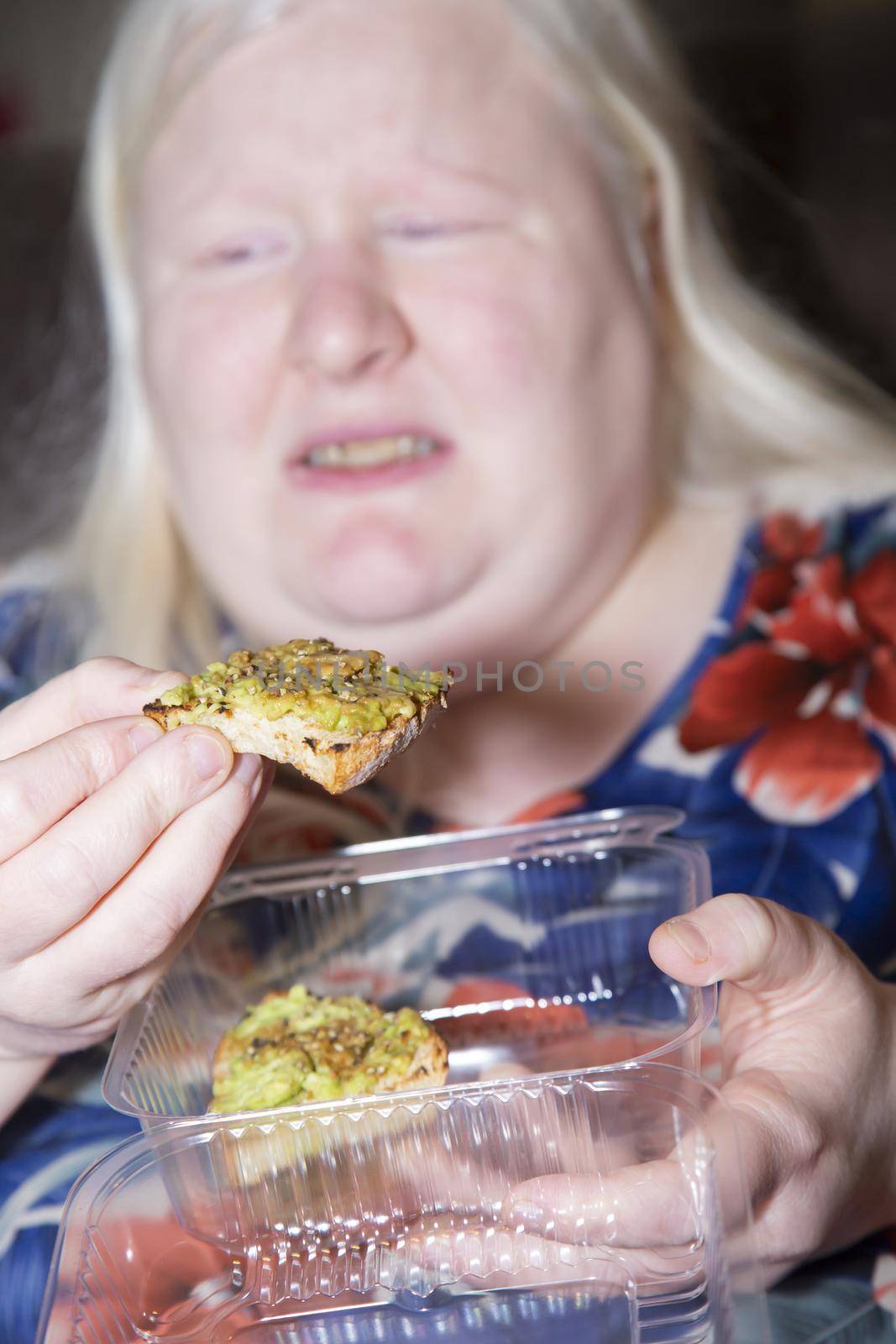 Albino woman suddenly gets a stomach ache while eating avocado toast