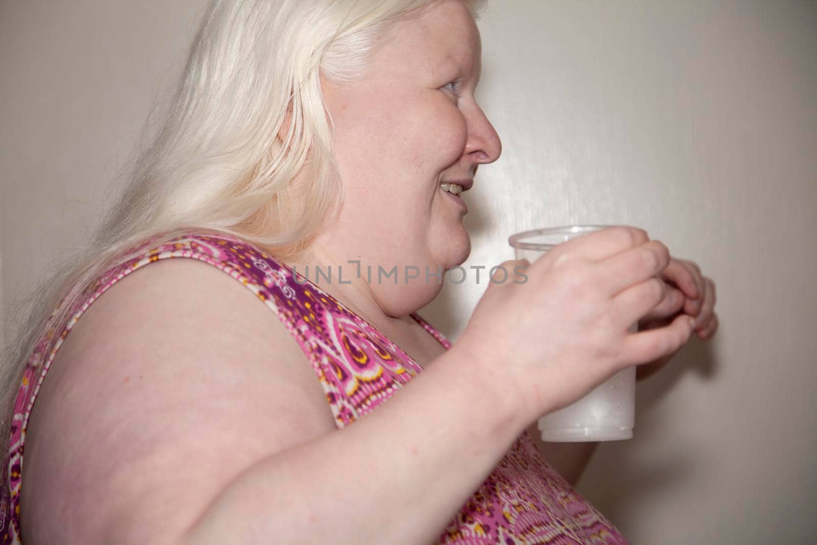 Albino woman holding a clear cup of drinking water indoors