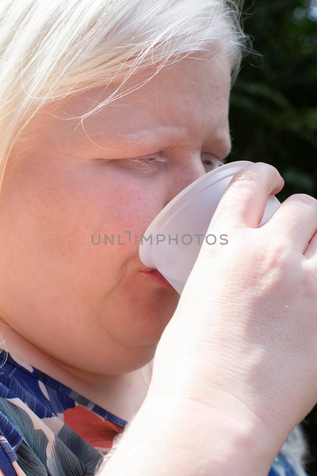 Albino woman enjoying a glass of water in a plastic cup