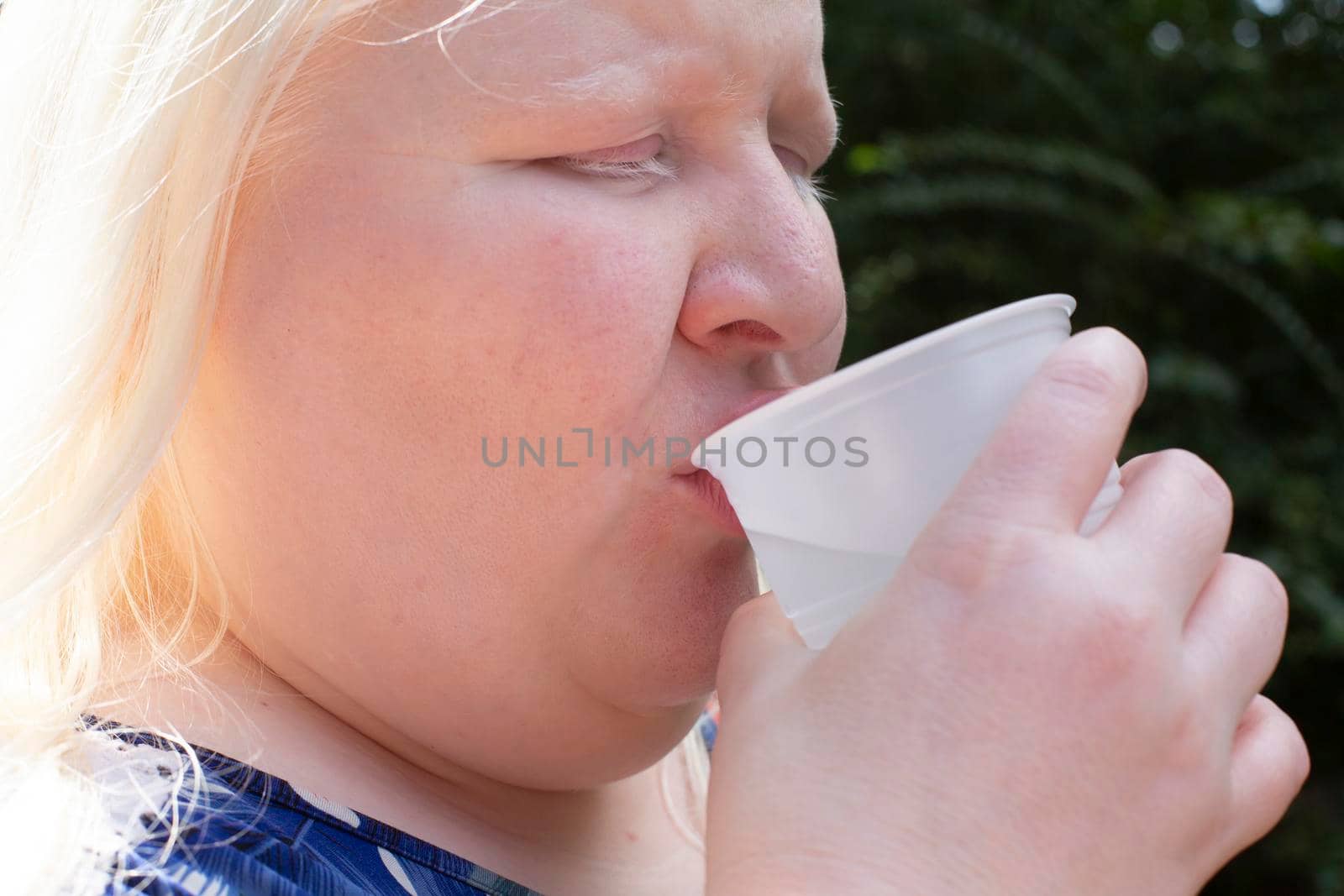 Albino woman enjoying a glass of water in a plastic cup