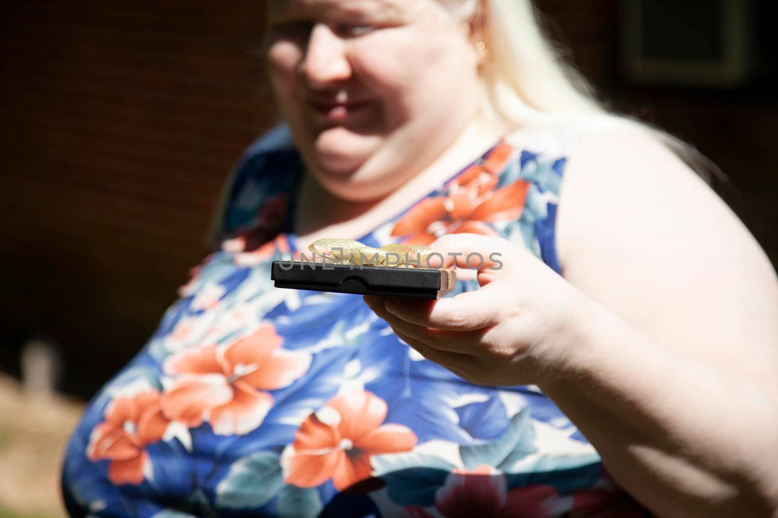 Albino woman holding a black gift box with a golden bow