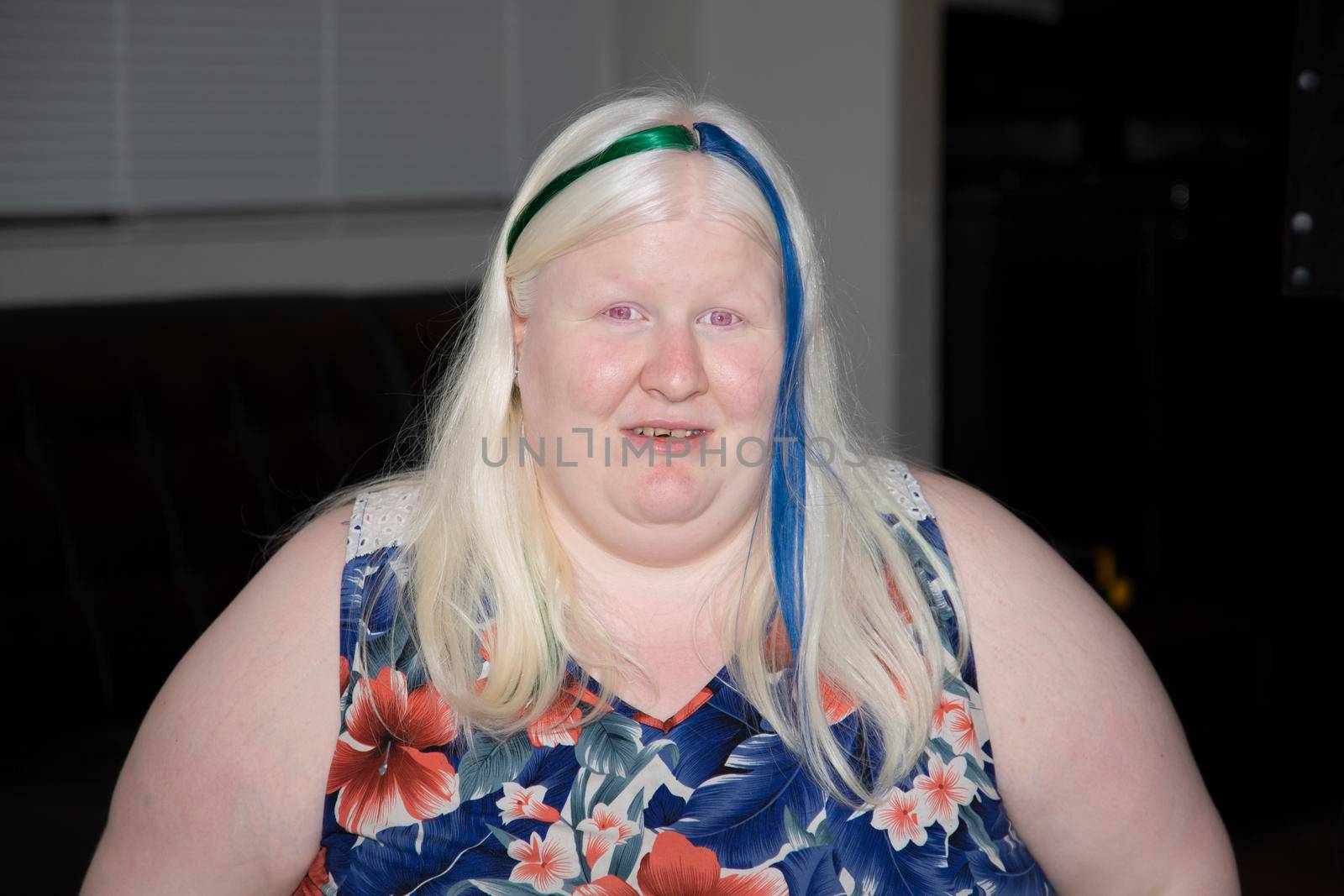Albino Woman Wearing Colored Hair by tornado98