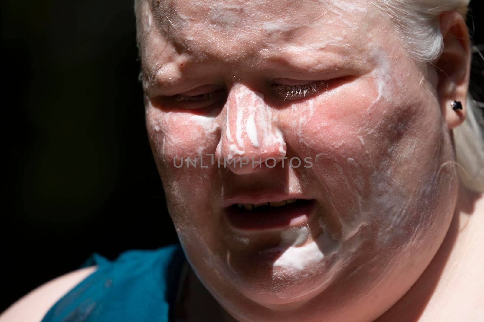 Close up of an albino woman slathered in sun screen