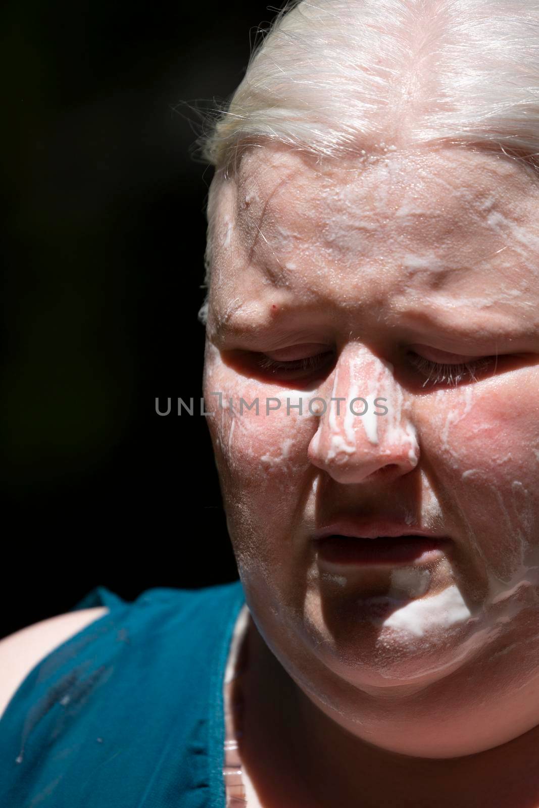 Close up of an albino woman slathered in sun screen
