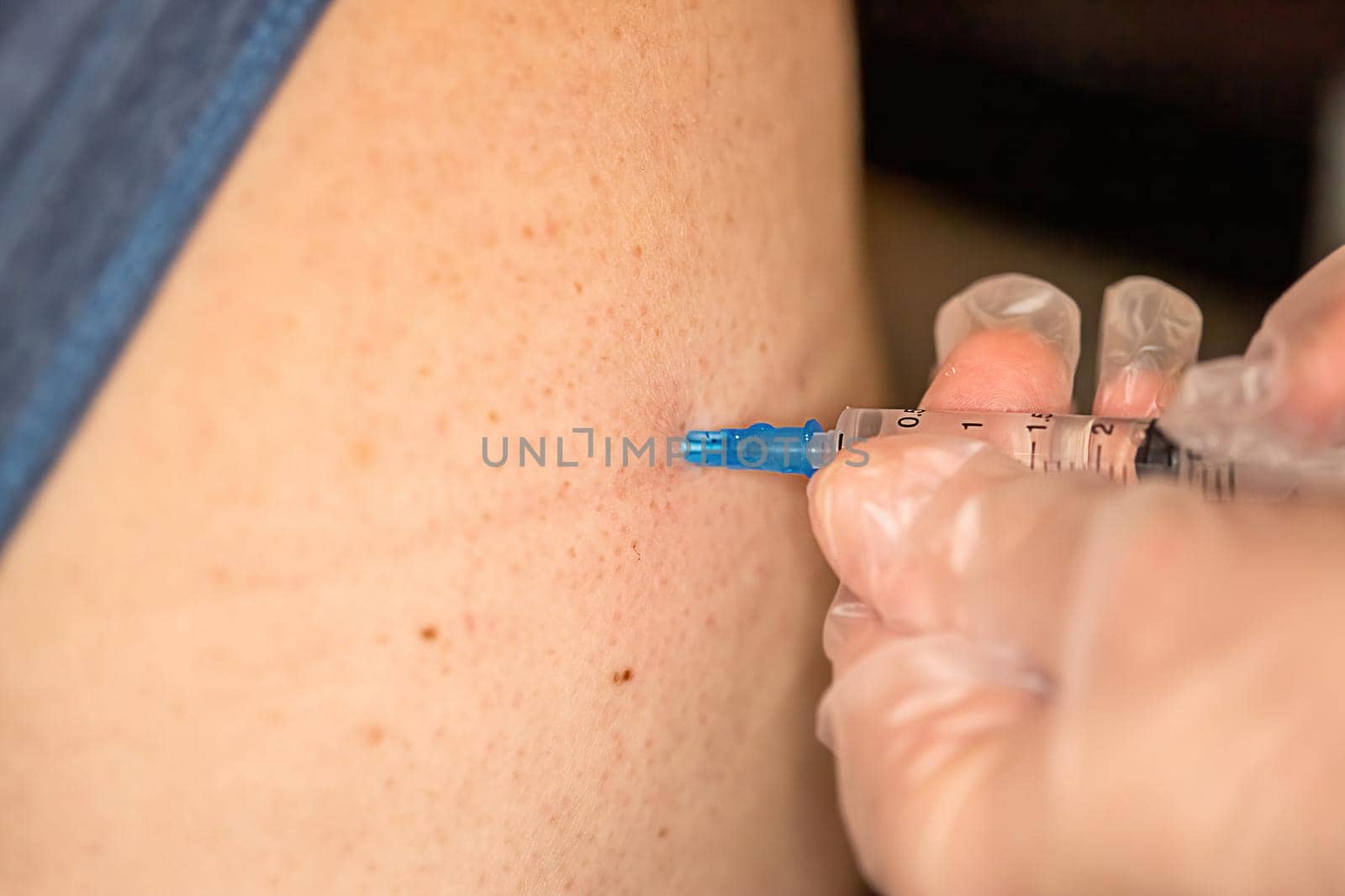 Close-up of a nurse's hands and a syringe that makes an injection into the buttock of a medicinal product
