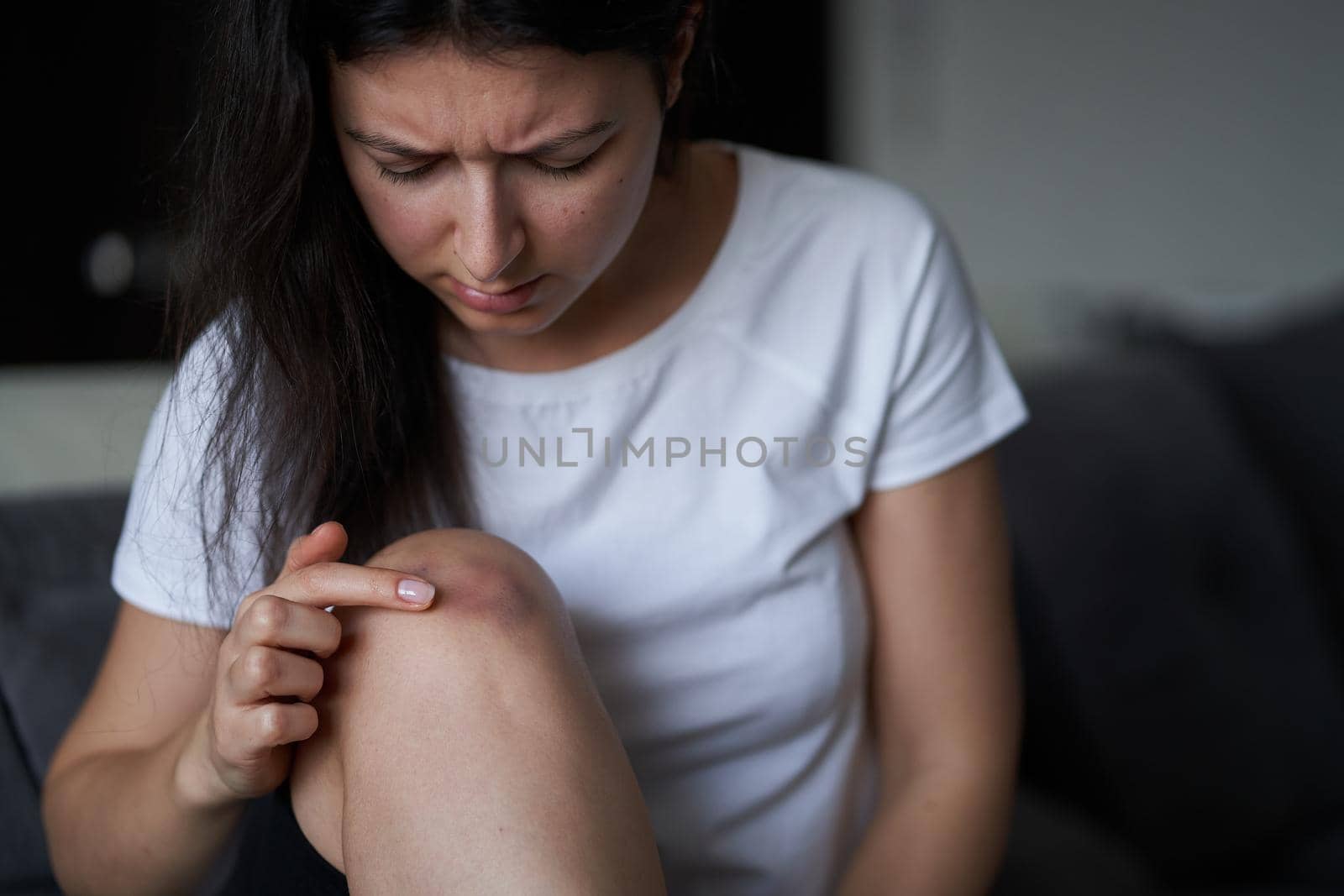 Close-up of a person massaging an injured knee joint. Bruise on the knee. Leg pain.