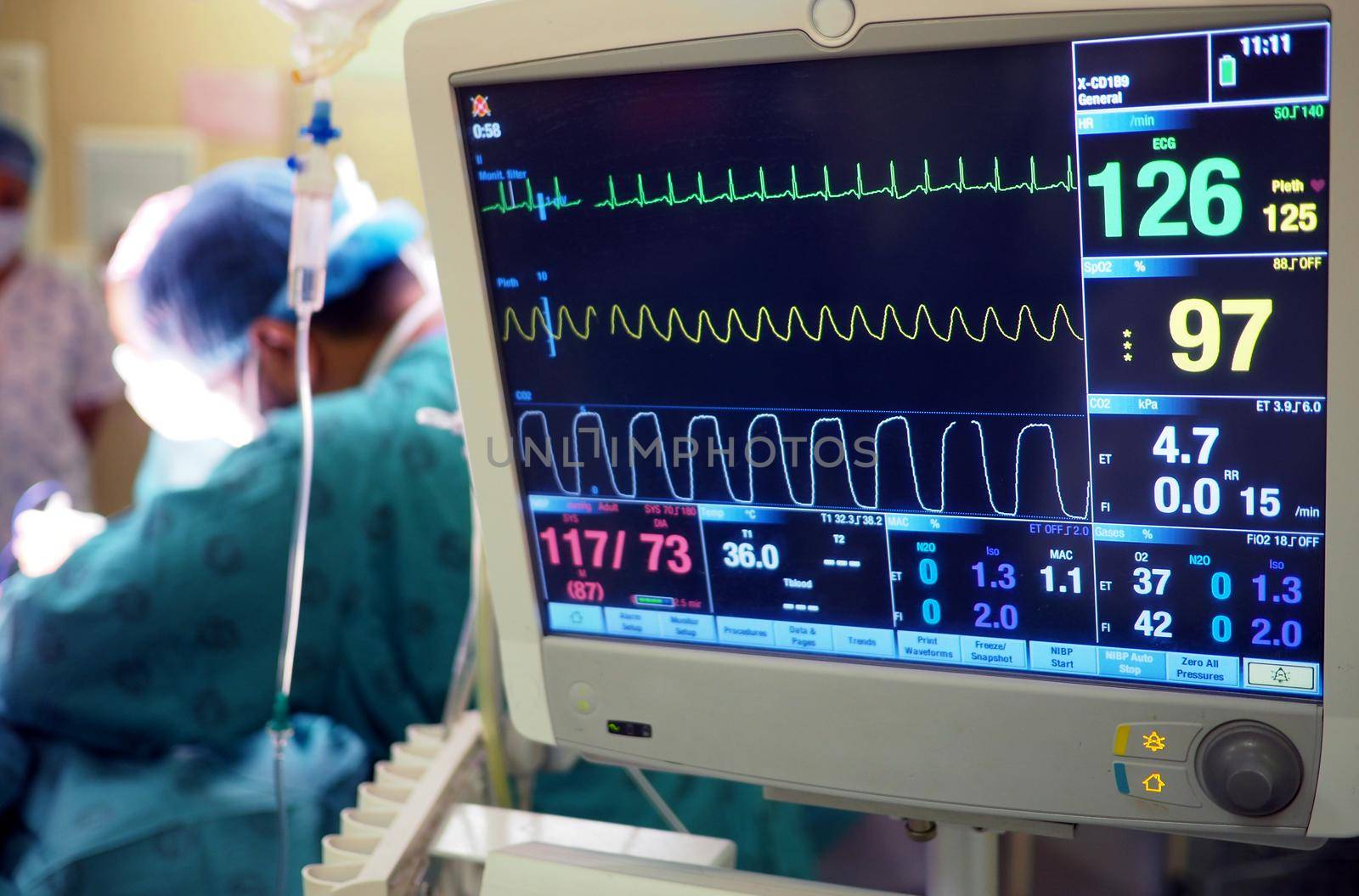 Hospital operating theatre with ECG machine