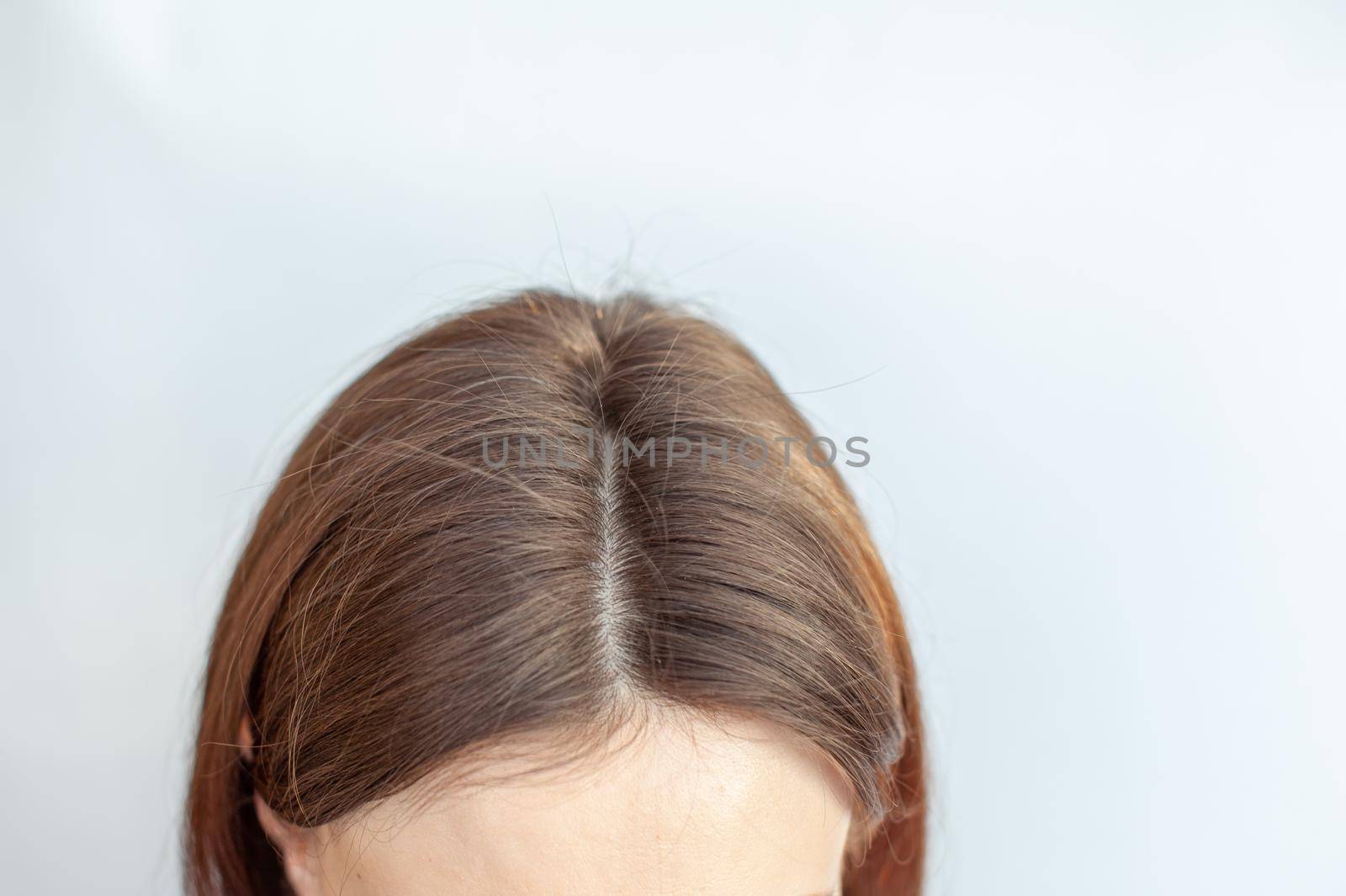 A woman's head with a parting of gray hair.  by AnatoliiFoto