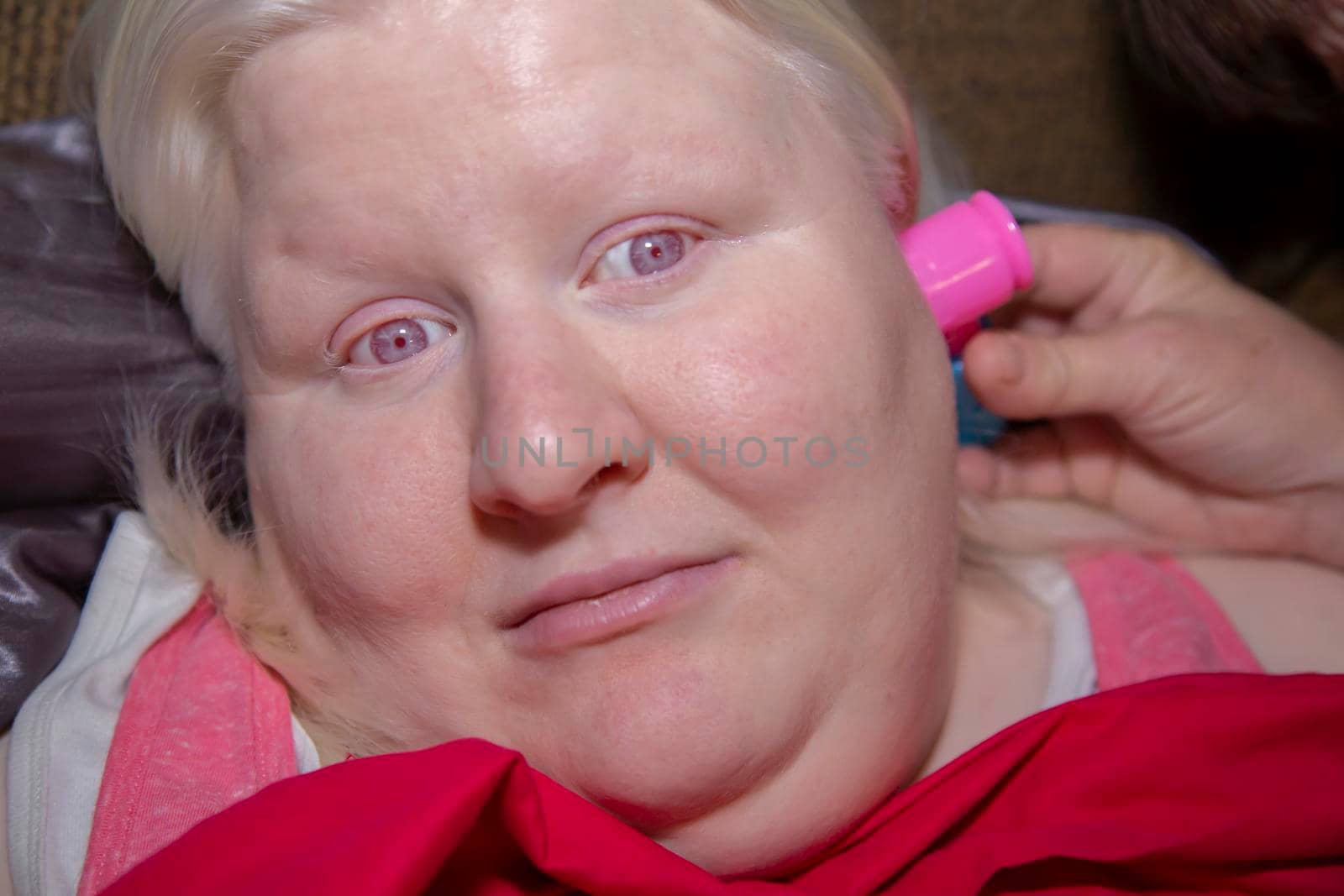 Someone checking an albino woman's ear with a toy