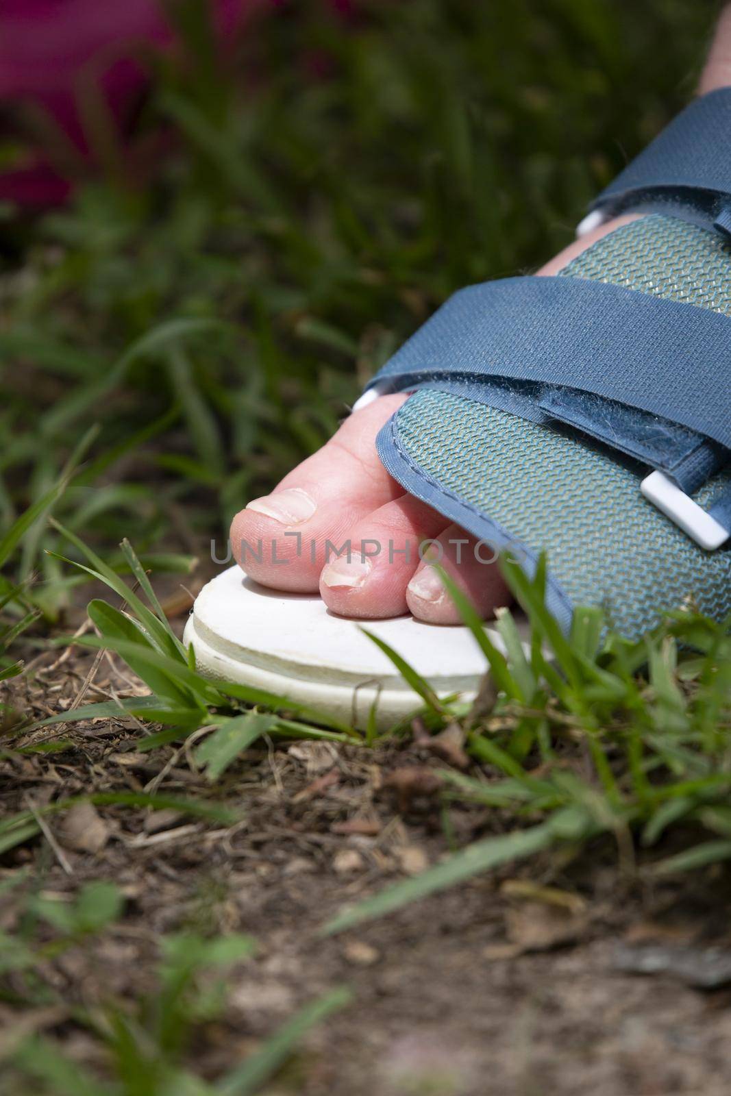 Woman wearing a shoe for a broken foot