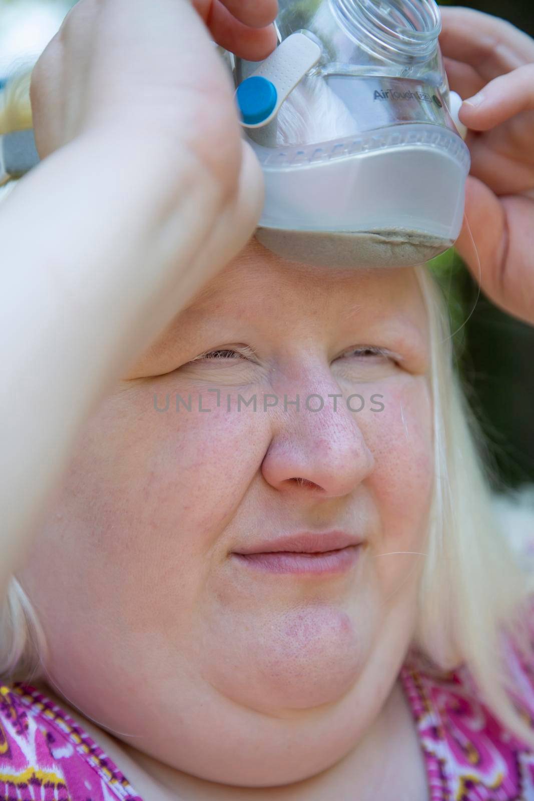 Albino woman putting on a CPAP mask outside