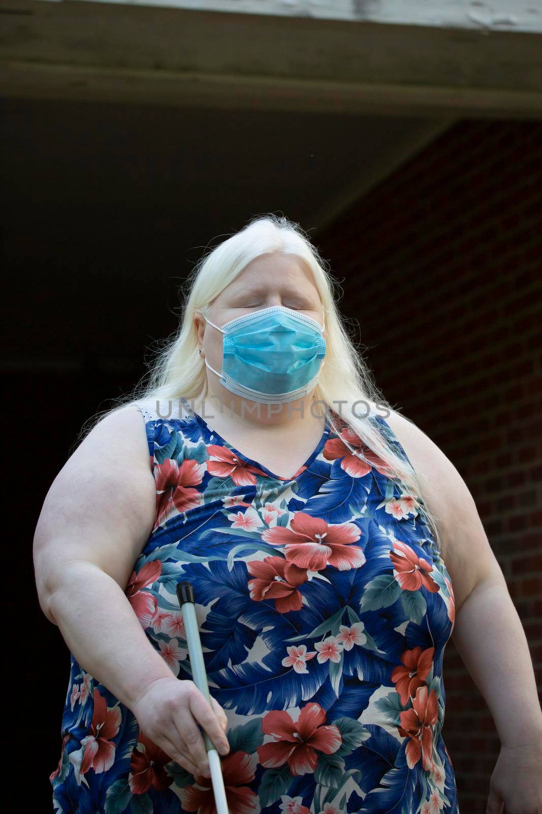 Close up of an albino woman wearing a medical mask and walking