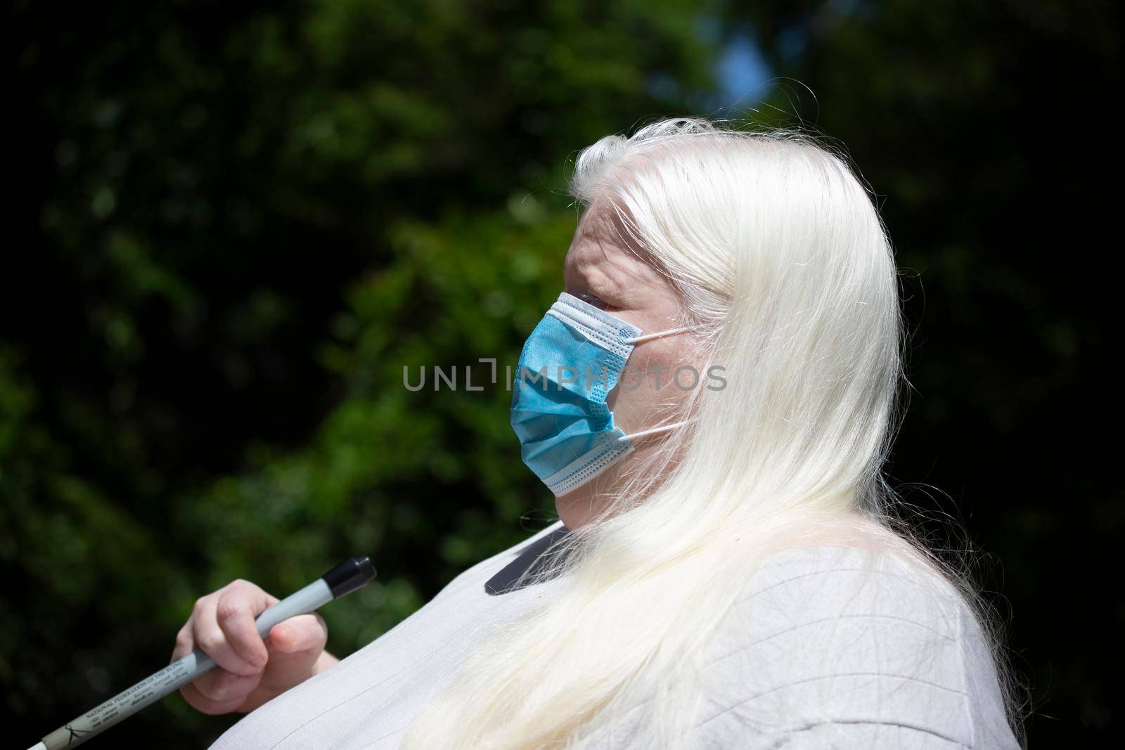 Close up of an albino woman wearing a medical mask