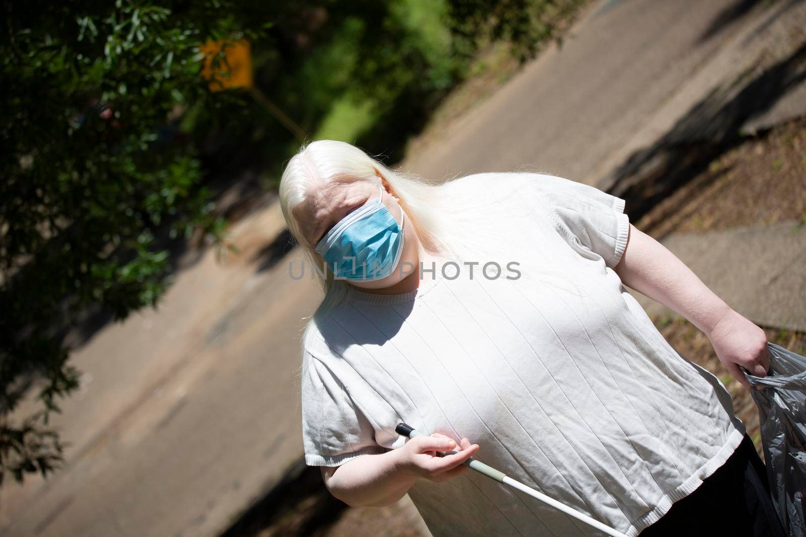 Close up of an albino woman wearing a medical mask