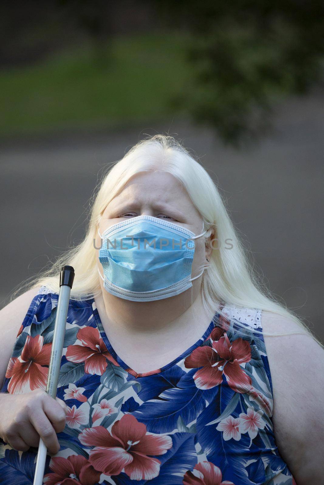Close up of an albino woman walking and wearing a medical mask