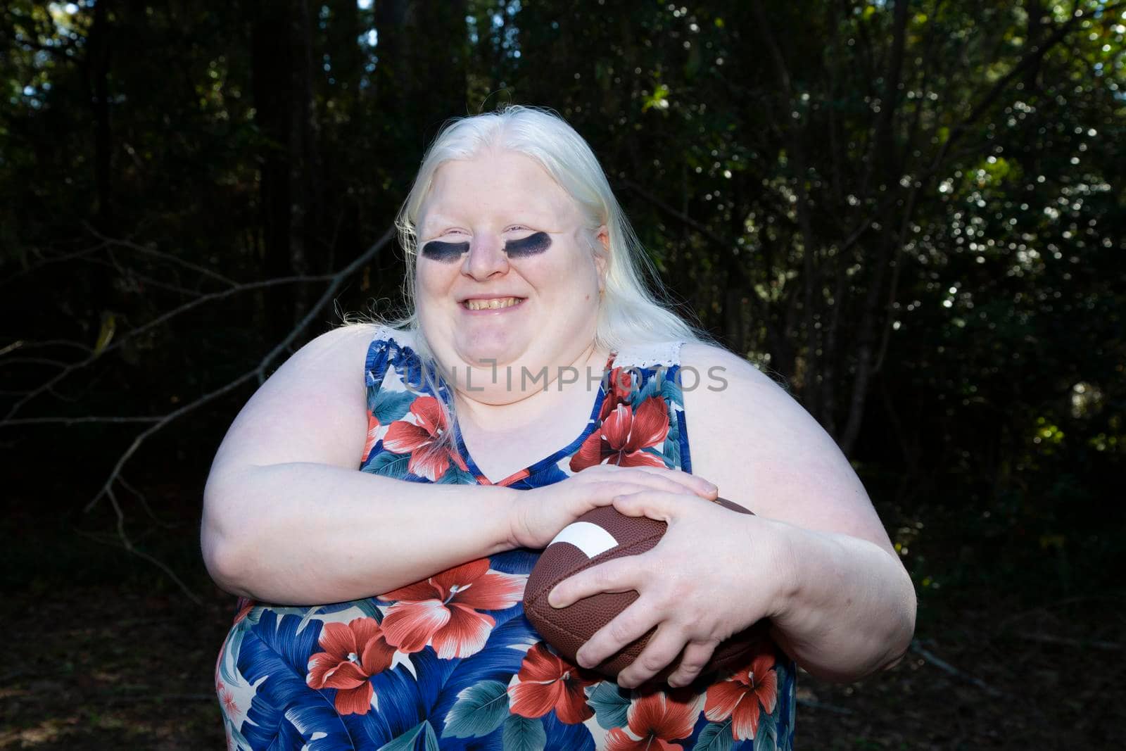 Albino woman protects a football as she prepares to run with it